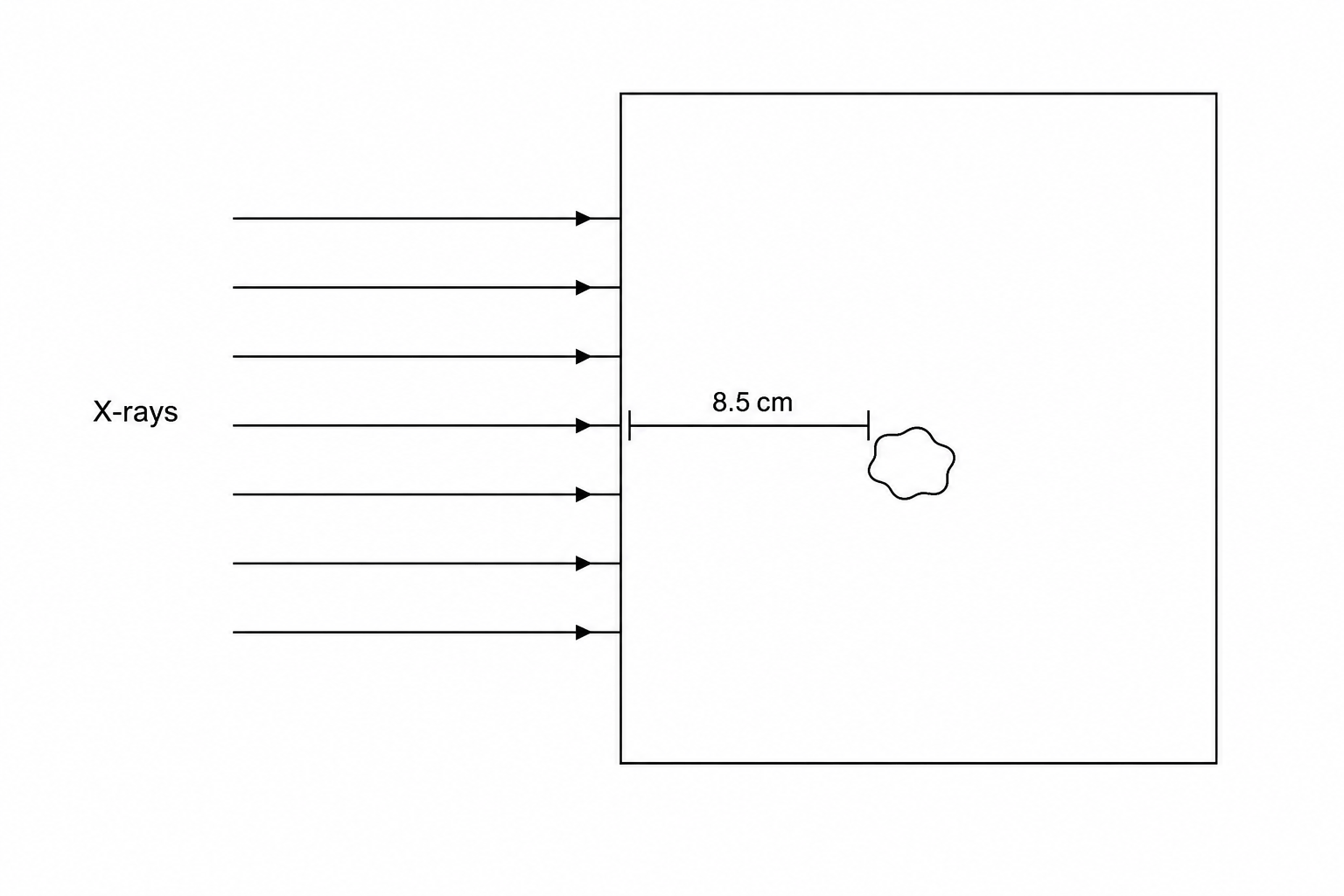 Parallel beam of X-rays incident normally on liver tissue