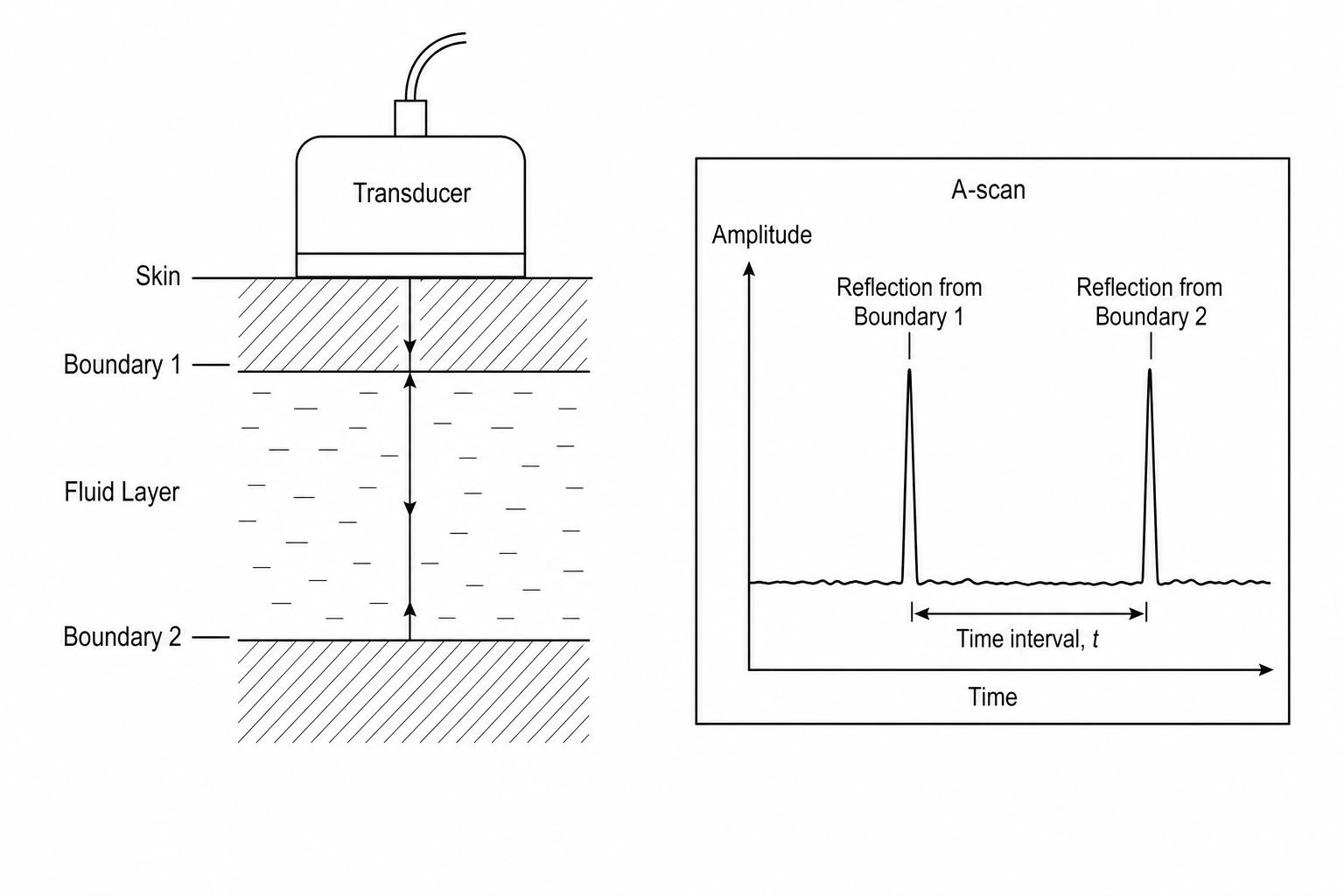 A-scan diagram