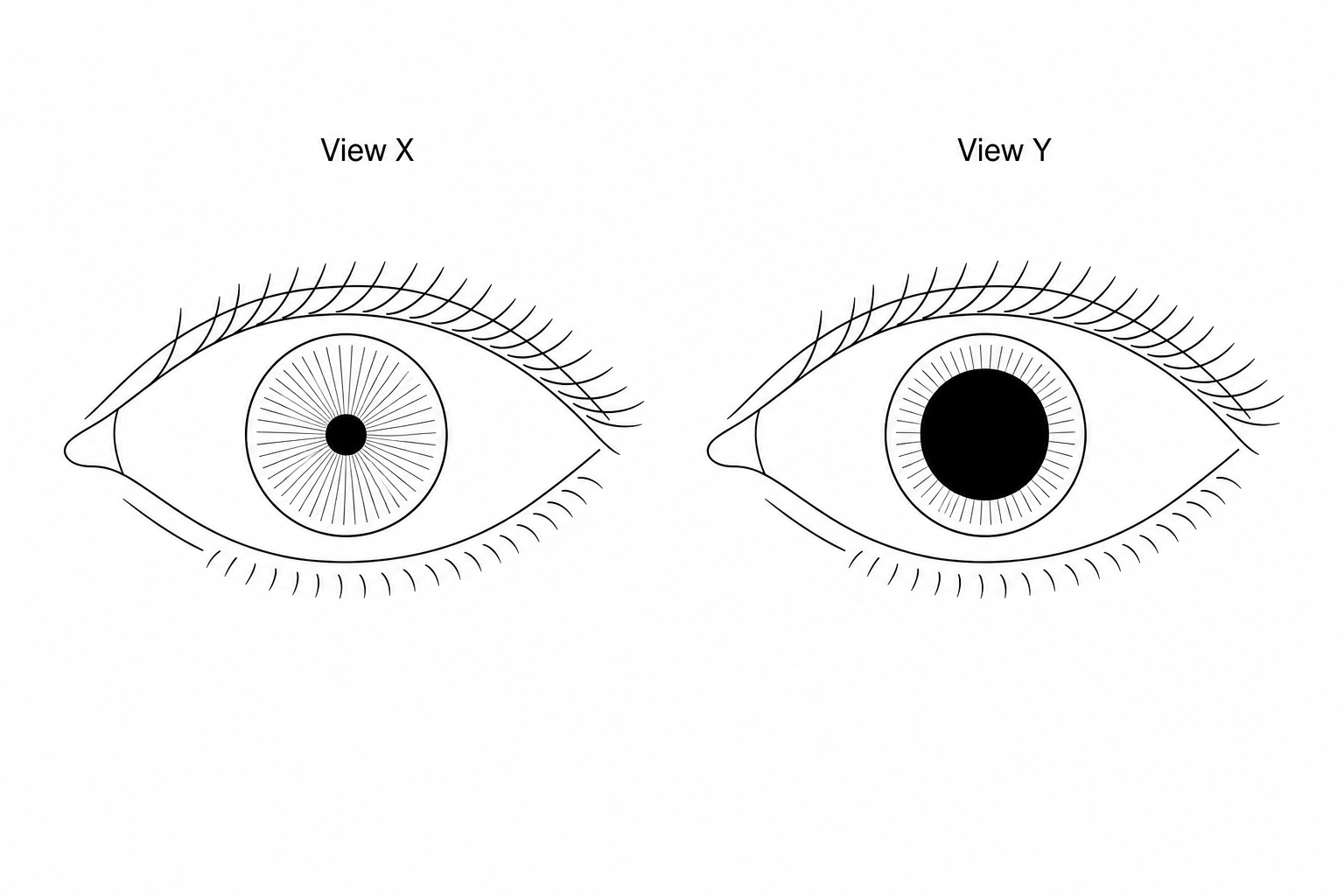 Diagram showing two views of a human eye: View X with a small pupil and View Y with a large pupil.
