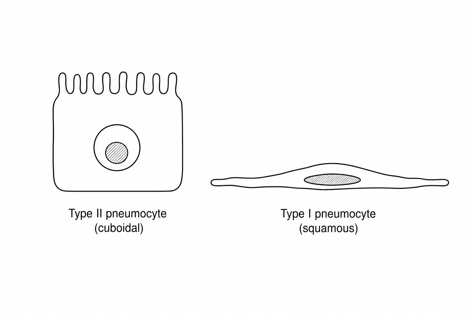 Diagram of Type II and Type I pneumocytes
