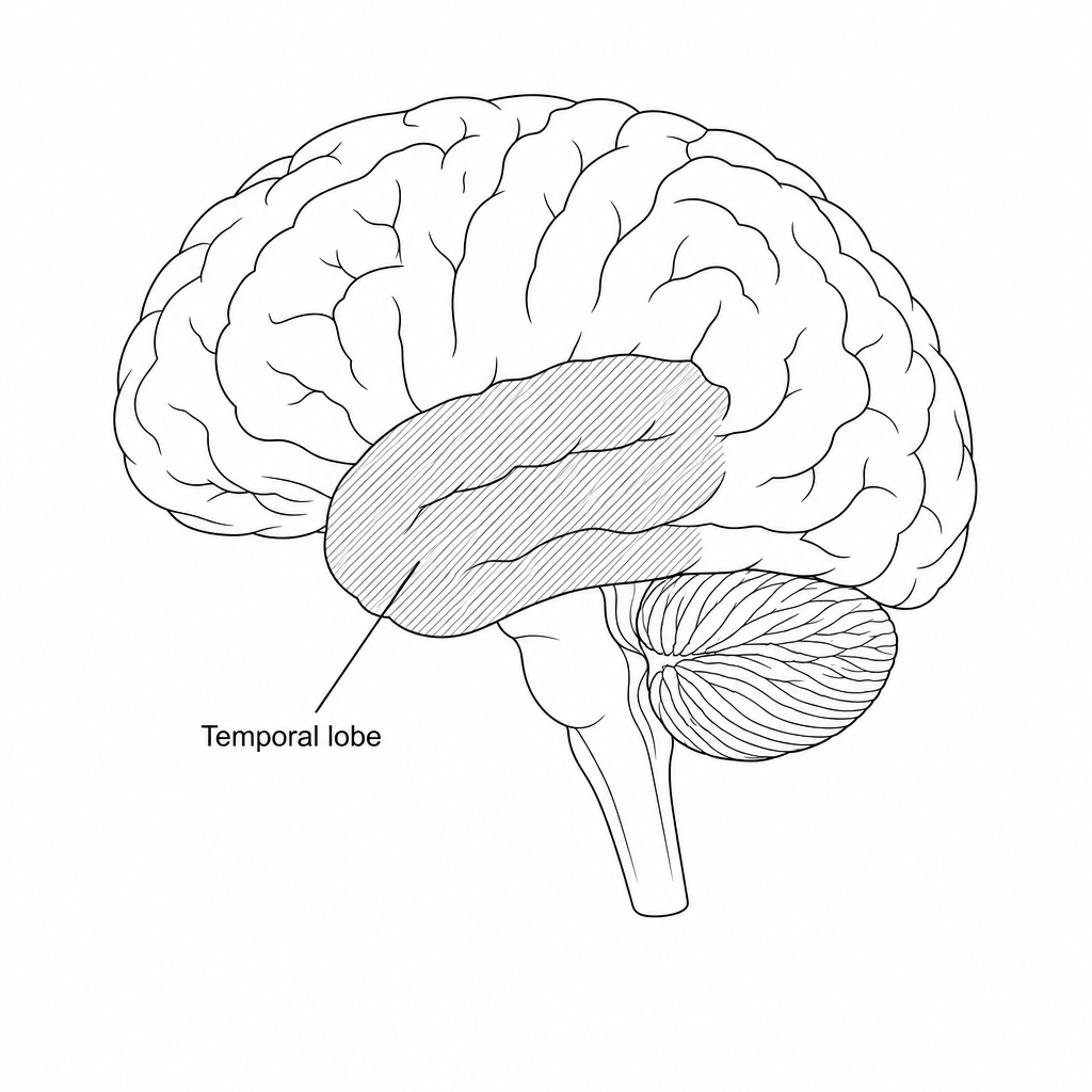 Lateral view of the human brain with the temporal lobe highlighted