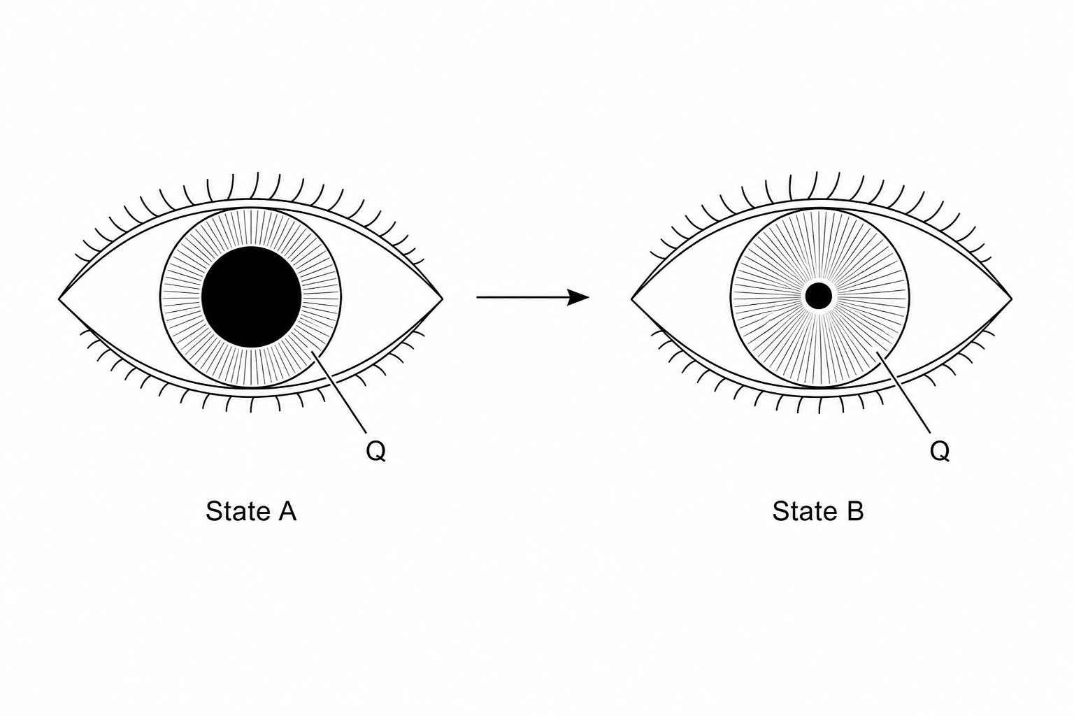 Diagram showing pupil change from State A to State B