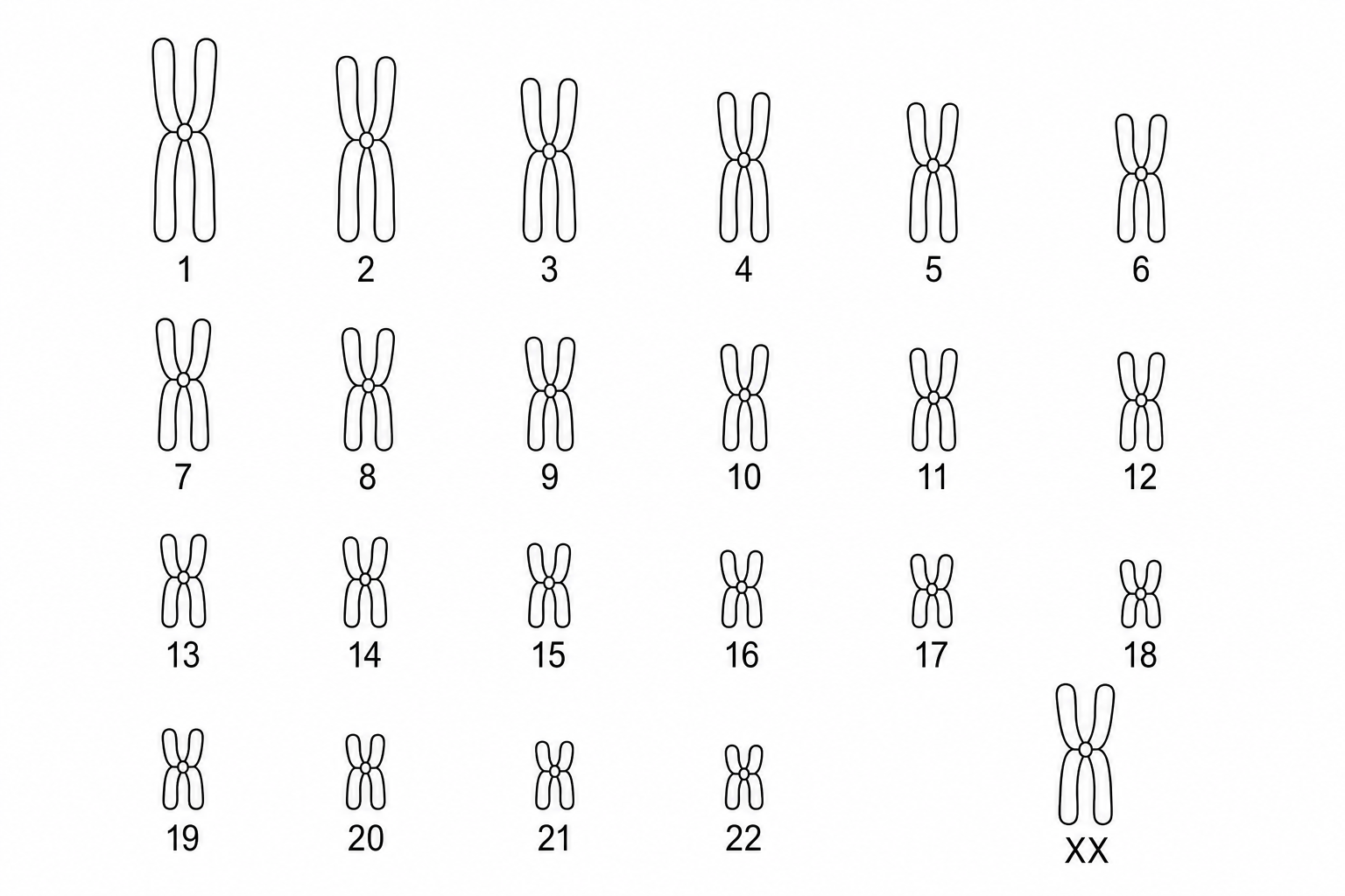 A human karyogram showing 23 pairs of chromosomes. Pairs 1 to 22 are autosomes arranged in order of decreasing size. The 23rd pair (located at the bottom right) consists of two large, identical homologous chromosomes labeled X, with no smaller Y chromosome present.