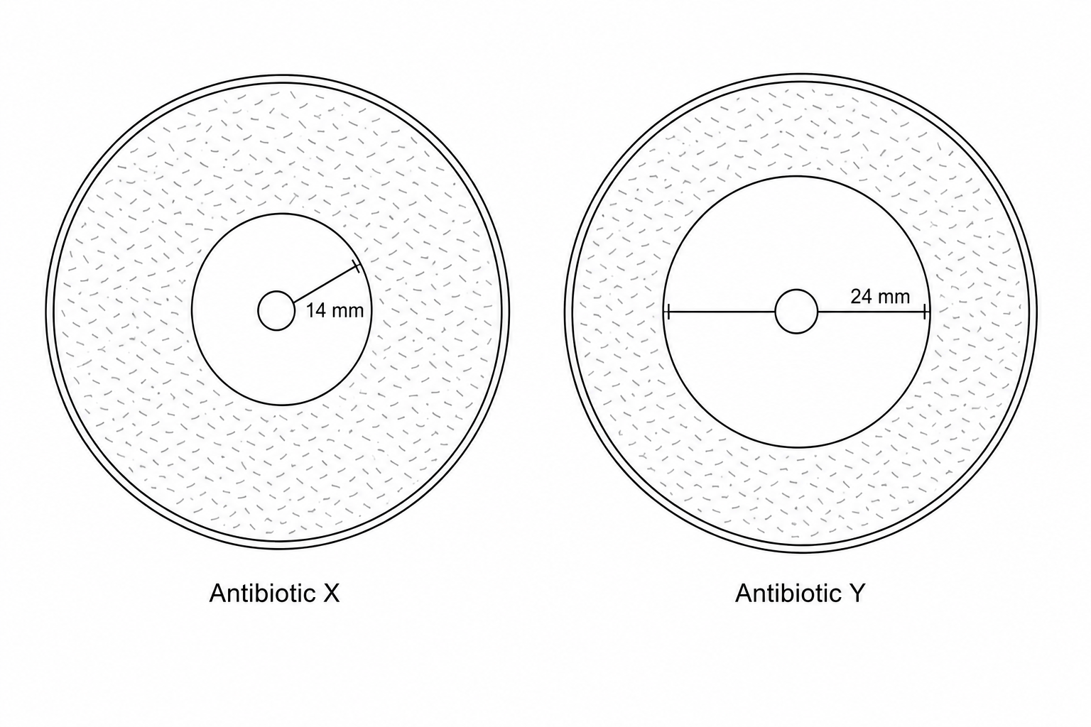 Two agar plates showing bacterial growth and clear zones of inhibition around discs of Antibiotic X and Antibiotic Y.
