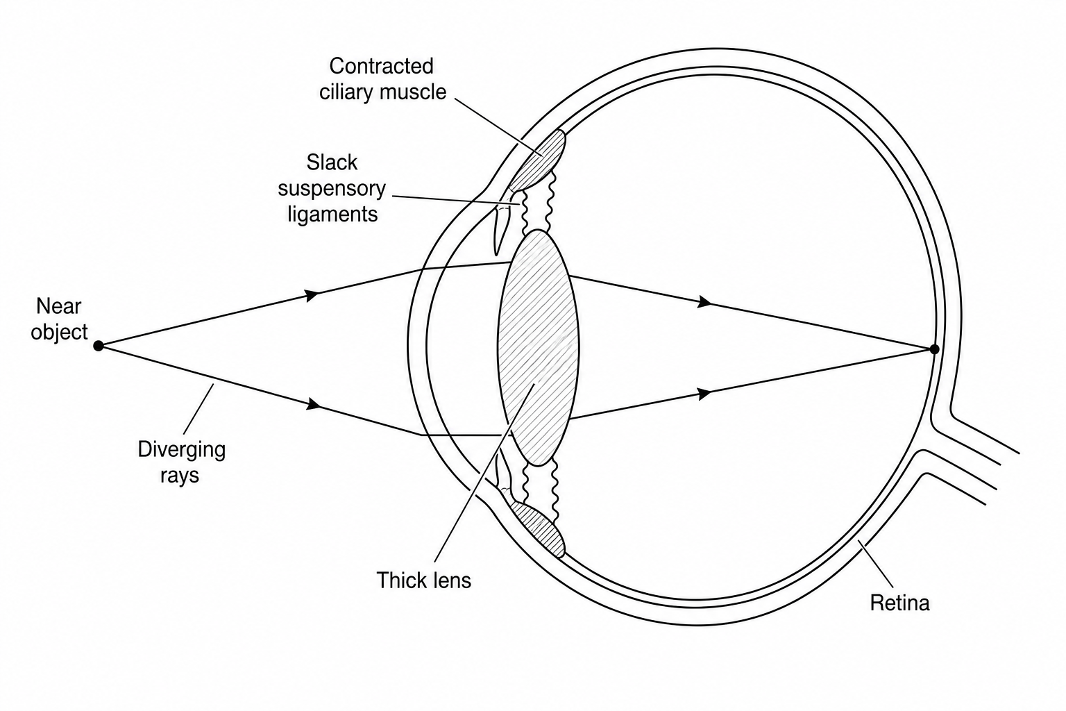 Diagram showing the cross-section of a human eye focusing on a nearby object.