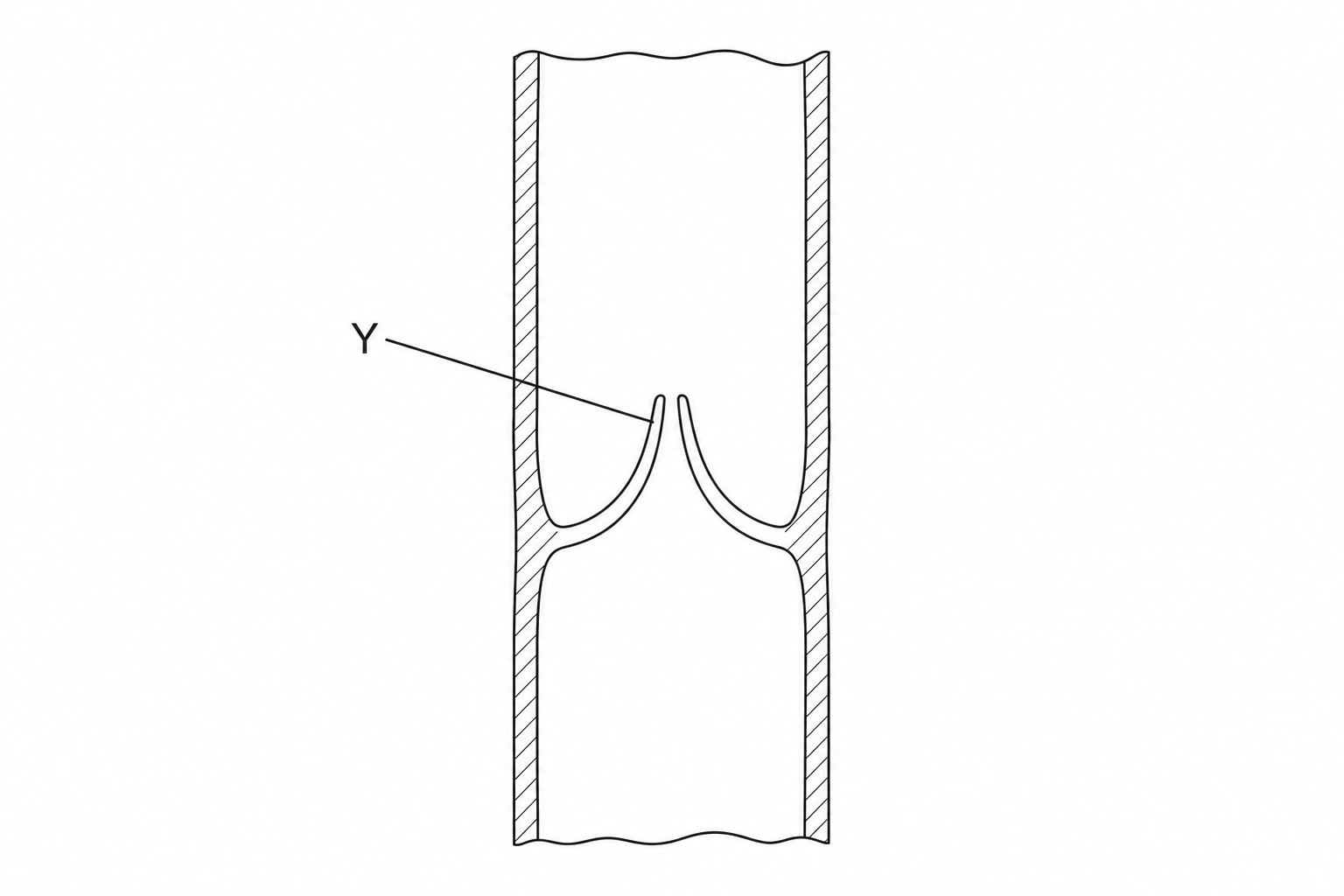 A diagram showing a longitudinal section of a human vein. The vessel has a wide lumen and a thin wall. Inside the lumen, there is a pair of pocket-like flaps pointing in the direction of blood flow, labelled with the letter Y.