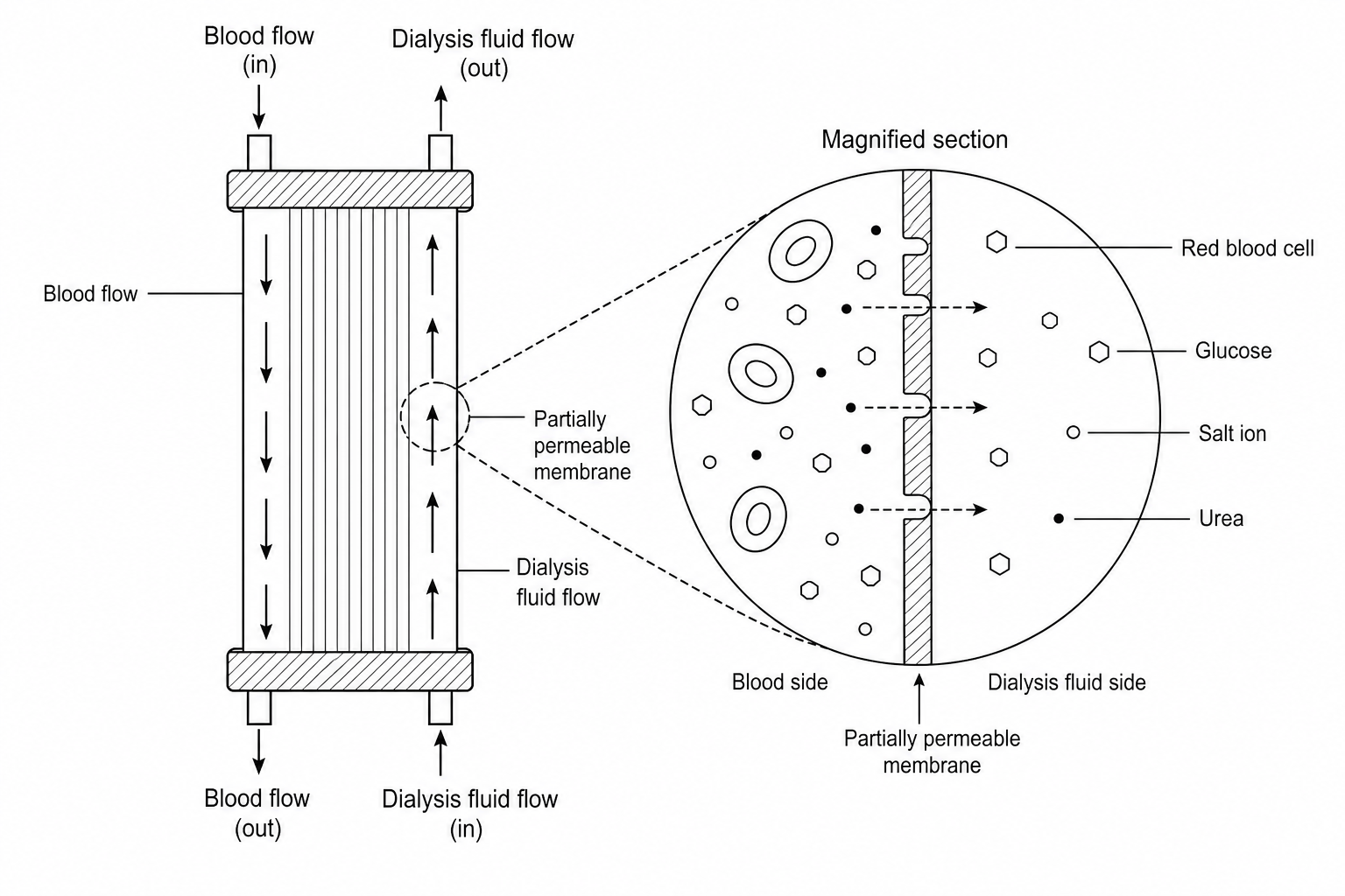 A schematic diagram of a dialysis machine cartridge. Blood from the patient's artery enters the top of the cartridge and flows downwards. Dialysis fluid enters from the bottom of the cartridge and flows upwards (counter-current flow). An inset magnified view shows a partially permeable membrane separating the blood chamber from the dialysis fluid chamber. Small green circles represent urea, blue circles represent salt ions, yellow hexagons represent glucose, and large red circles represent red blood cells.