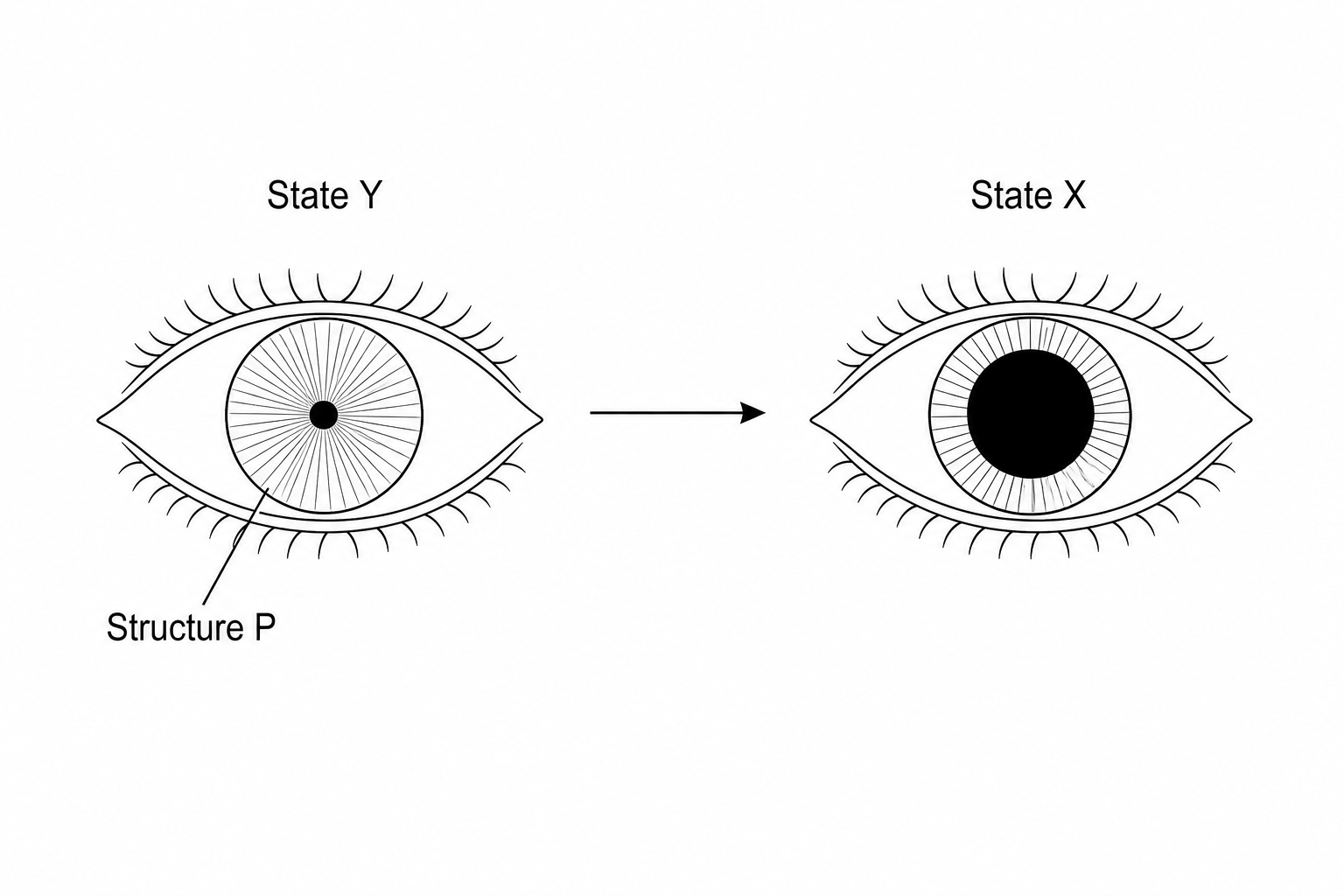 Diagram showing the front view of two human eyes. In State Y, the pupil is small and constricted. An arrow points to State X, where the pupil is much larger and dilated. The colored ring surrounding the pupil is labeled Structure P.