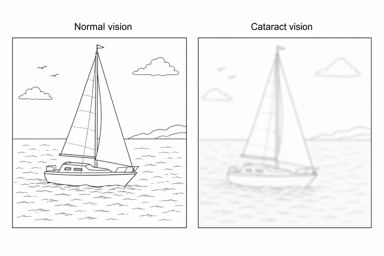 Figure 1: Illustration comparing normal vision and vision with a cataract. On the left, normal vision shows a sharp, bright, and colorful image of a sailboat at sea. On the right, cataract vision shows the same sailboat but it is highly blurred, dimmed, and the colors appear faded.
