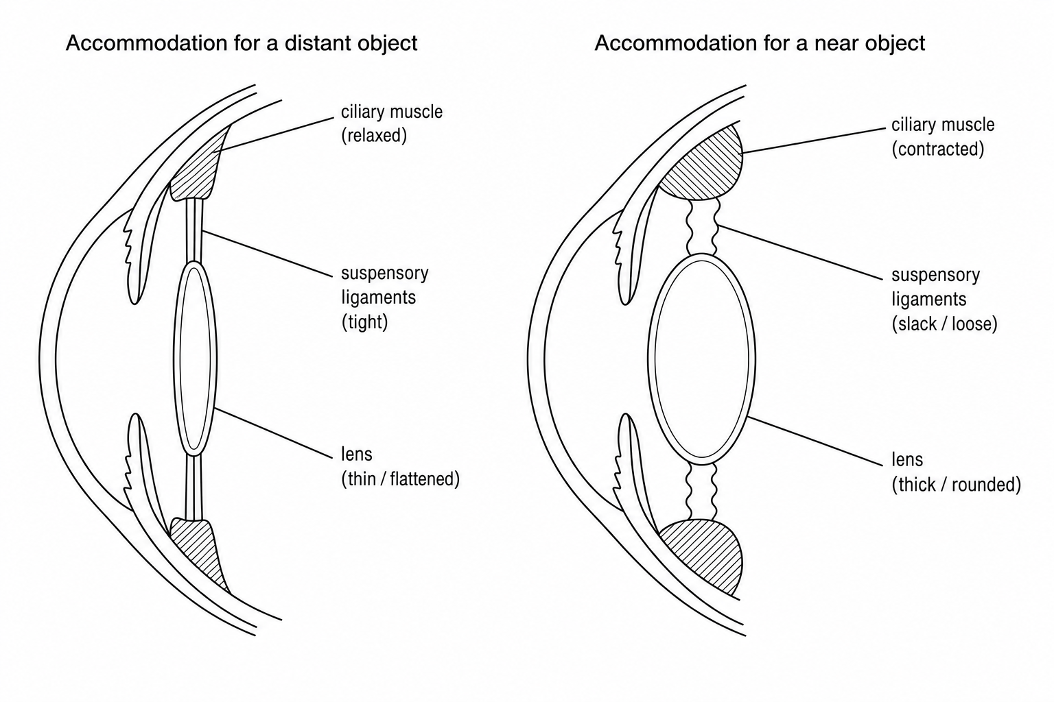 Accommodation mechanism of the human eye