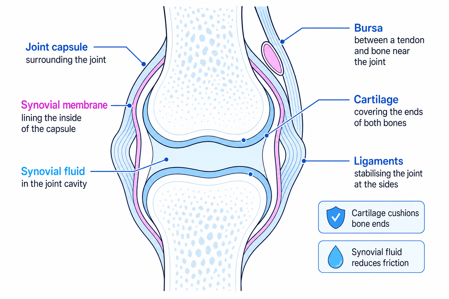 Labelled cross-section of a synovial joint showing joint capsule, synovial membrane, synovial fluid, cartilage, ligaments and a bursa