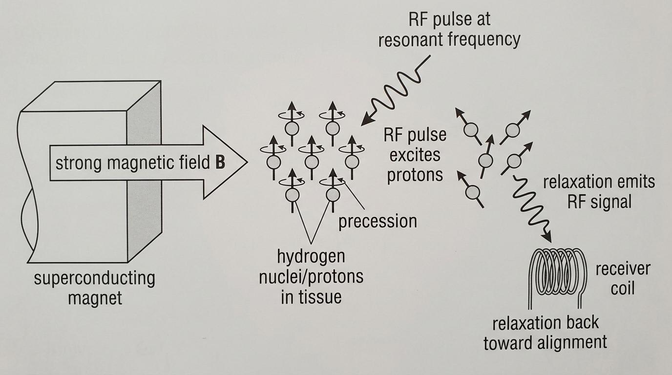 Schematic showing hydrogen nuclei aligning with a strong magnetic field, precessing, then being excited by an RF pulse and emitting an RF signal during relaxation
