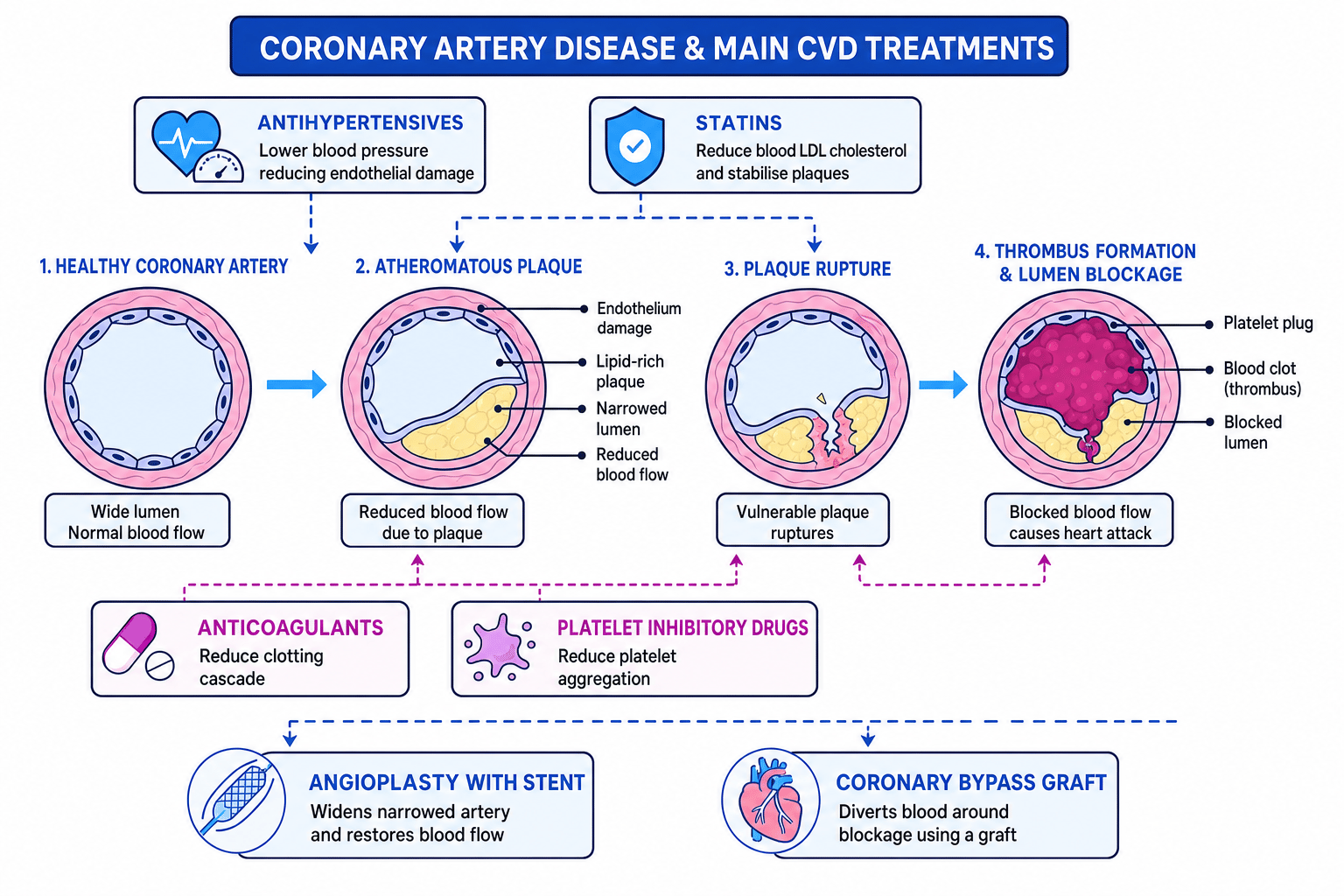 Flow diagram of atherosclerosis and CVD treatments