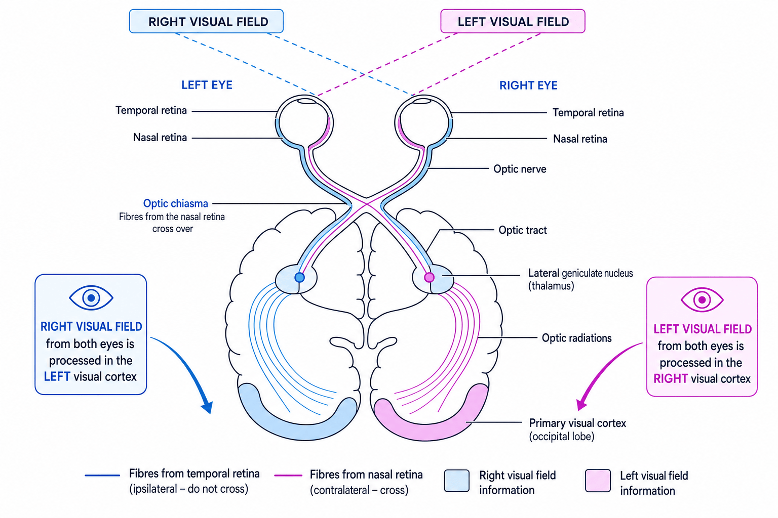 Schematic of the visual pathway from both eyes to the primary visual cortex