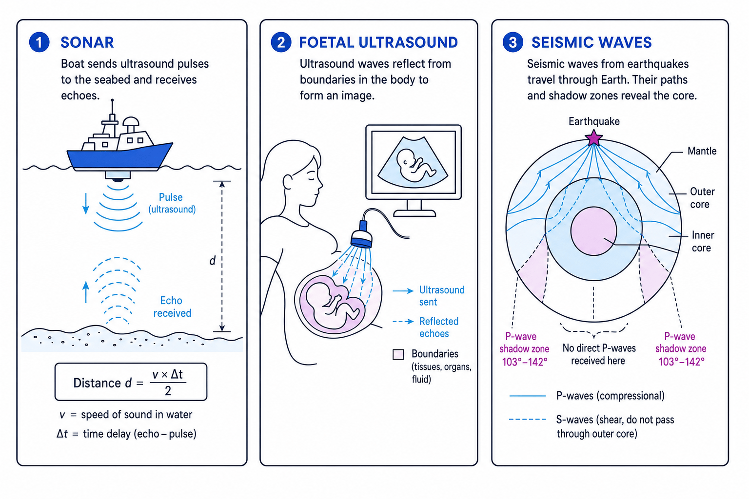 Three uses of ultrasound and infrasound: sonar, foetal scanning and seismic waves through Earth