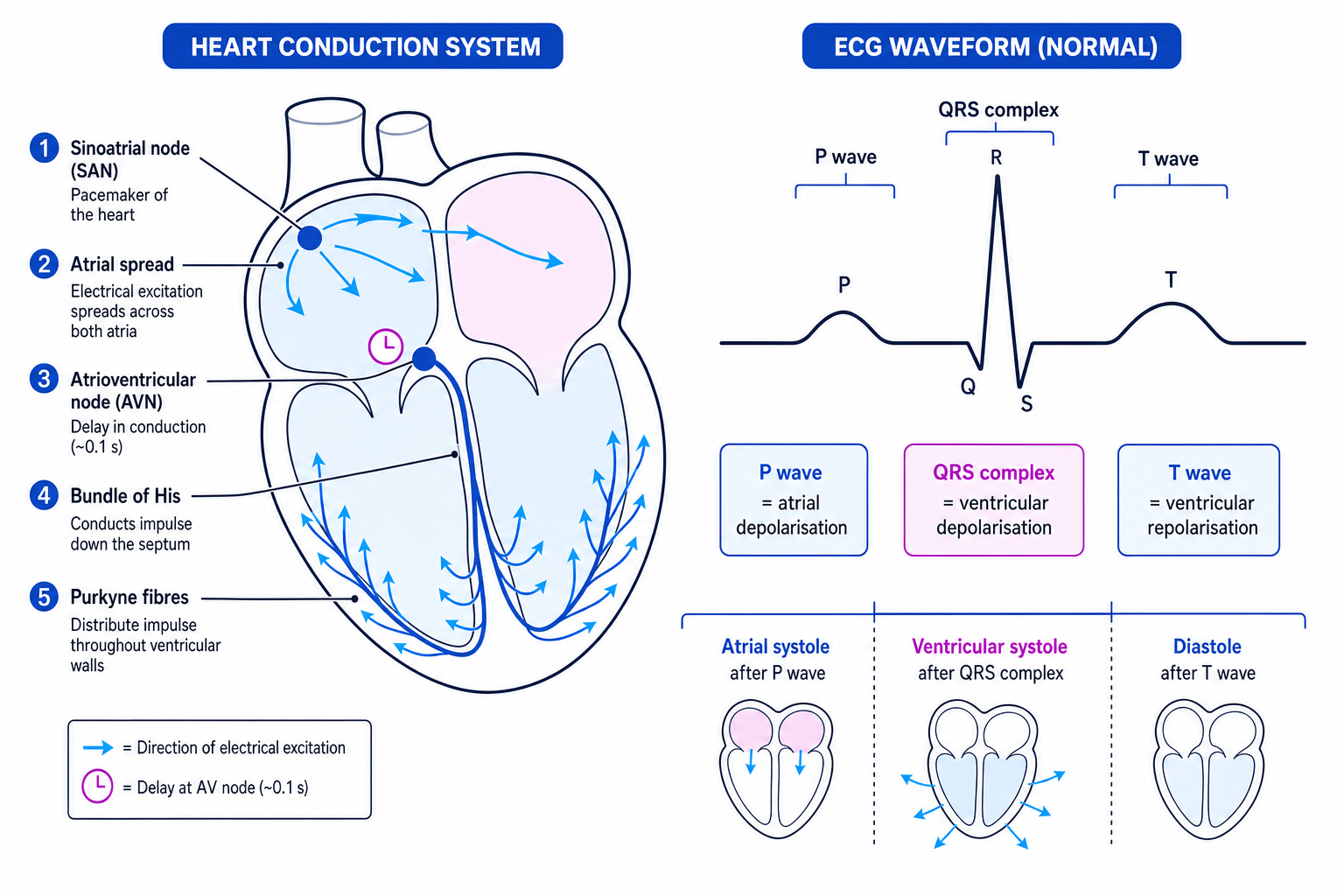 Heart conduction system linked to a normal ECG trace