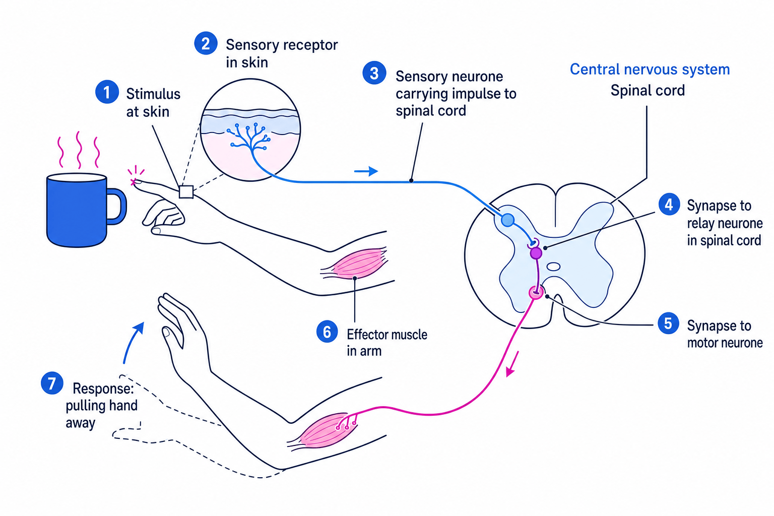 Labelled reflex arc showing sensory receptor, sensory neurone, relay neurone, motor neurone, effector muscle and withdrawal response
