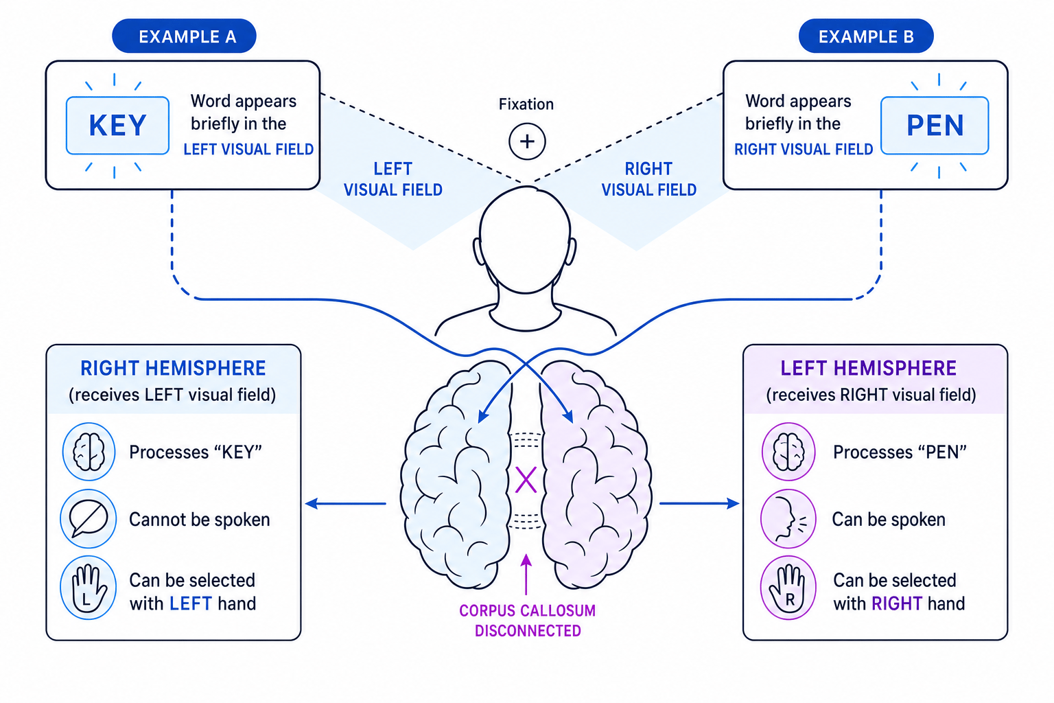 Split-brain research setup showing visual fields projecting to opposite hemispheres and different verbal/hand responses