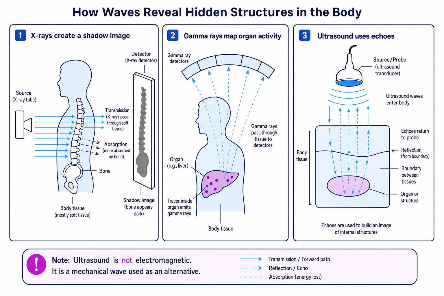 Schematic comparing X-ray imaging, gamma tracer imaging and ultrasound echoes