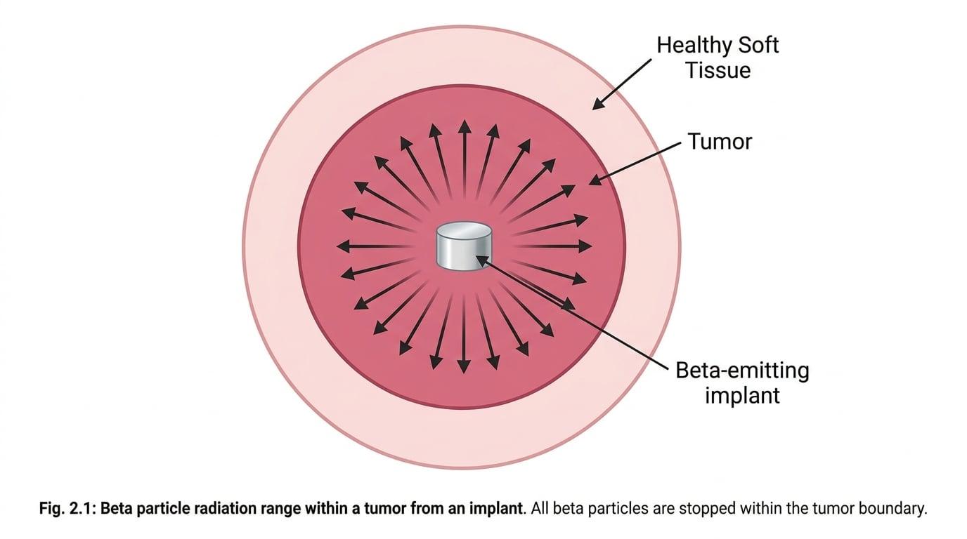 Cross-section of a tumour showing beta particles from an implant stopping before reaching healthy tissue.