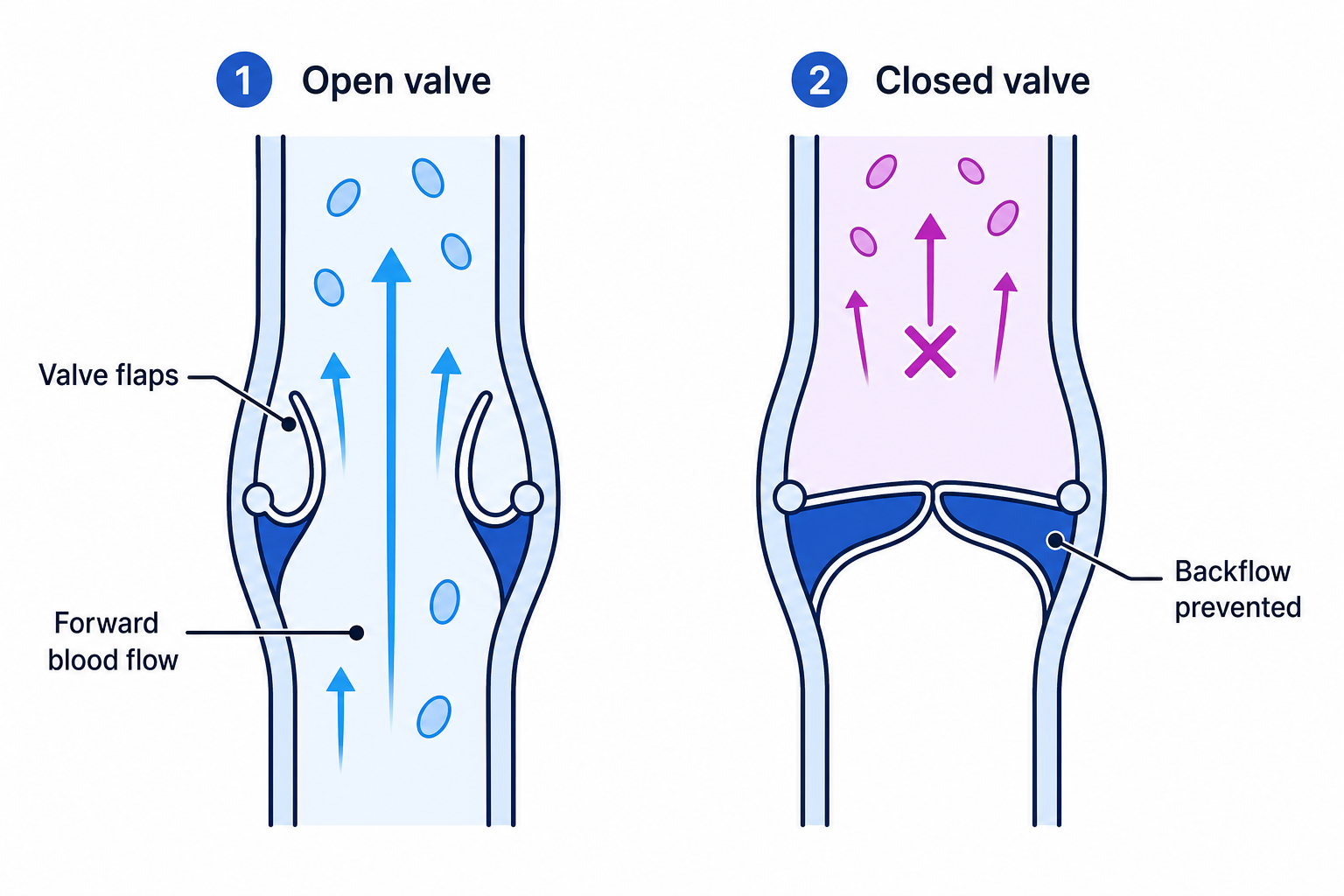 A normal heart valve opens to allow forward flow and closes to prevent backflow.