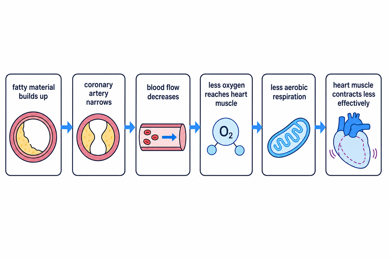 A cause-and-effect flow diagram linking fatty deposits in coronary arteries to reduced heart muscle contraction.