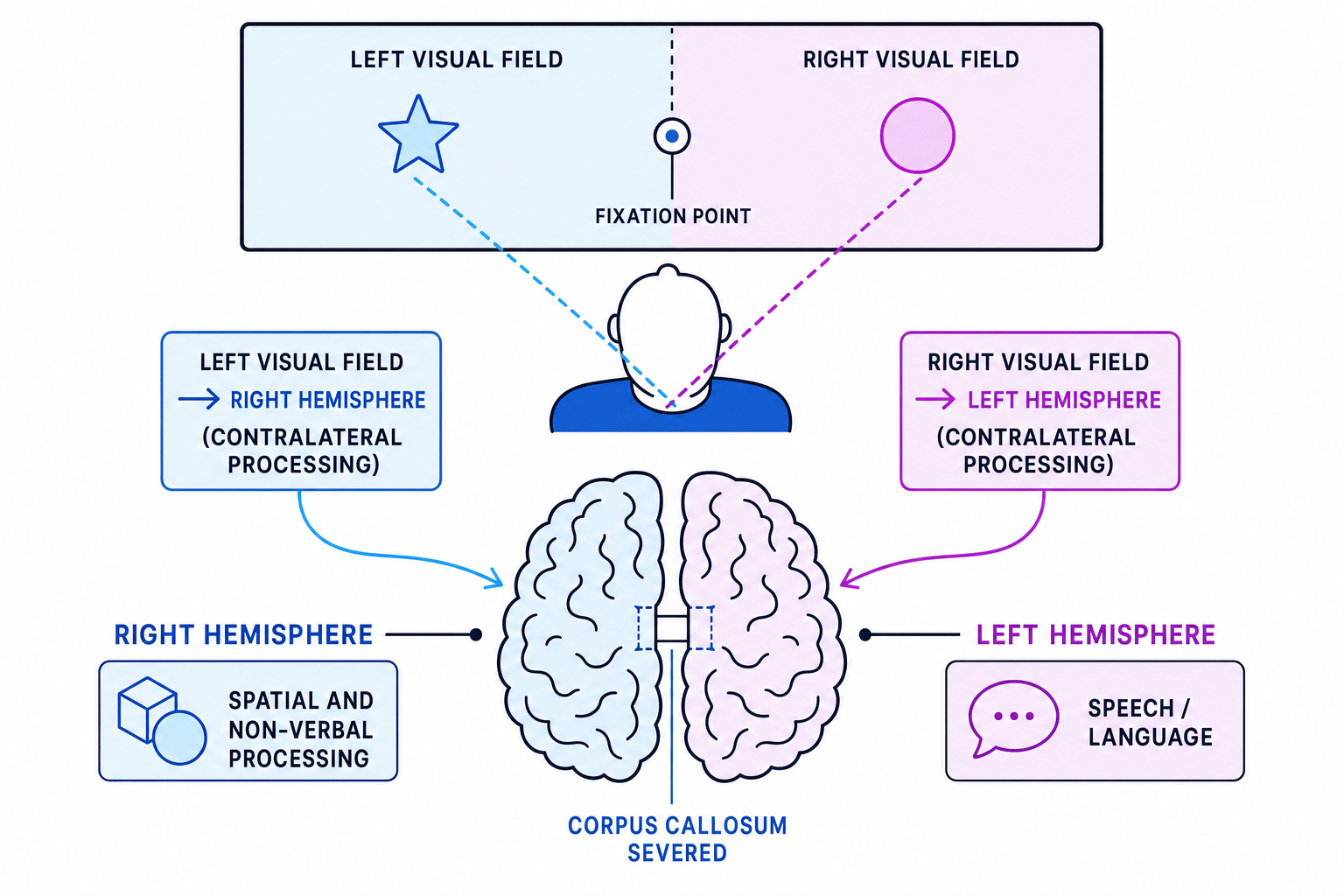 Diagram of Sperry's split-brain visual-field task showing left visual field projecting to the right hemisphere, right visual field projecting to the left hemisphere, a central fixation point, and a severed corpus callosum