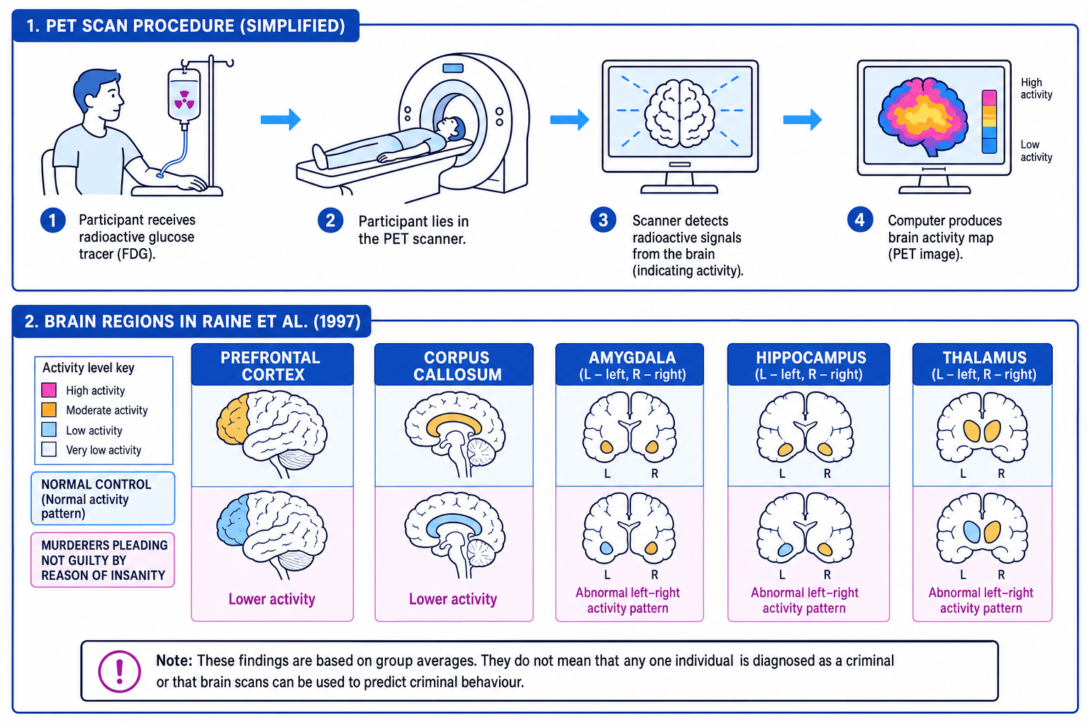 PET scan procedure and brain regions in Raine et al. 1997