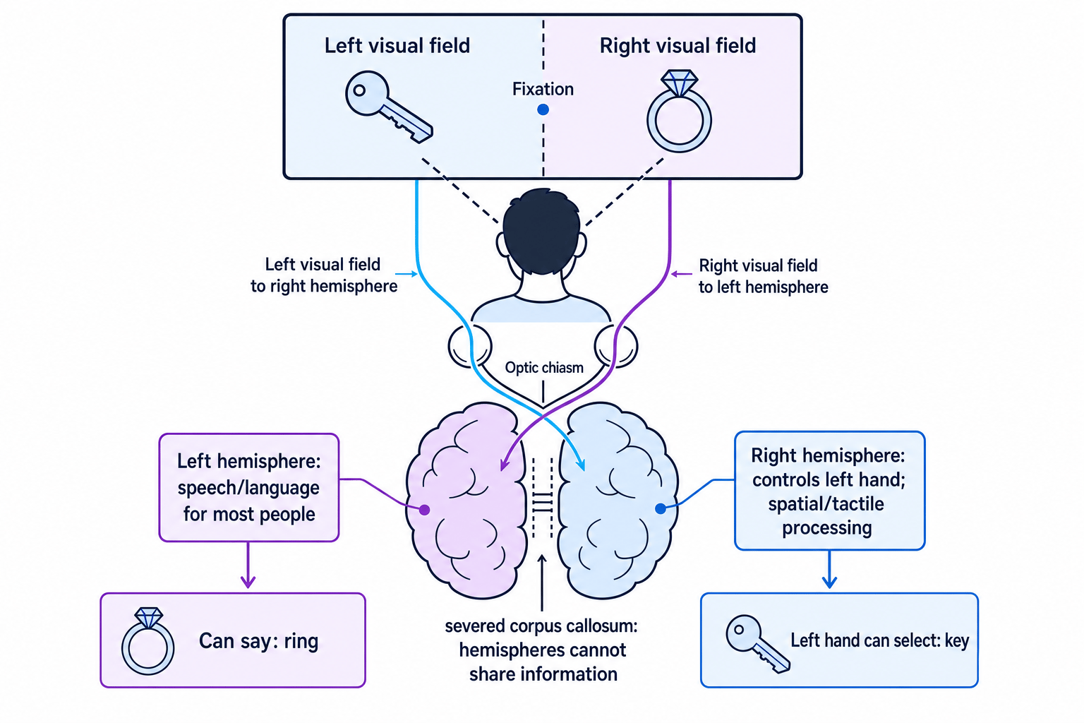 Diagram showing Sperry's split-brain visual-field procedure, with left visual field projecting to the right hemisphere and right visual field projecting to the left hemisphere