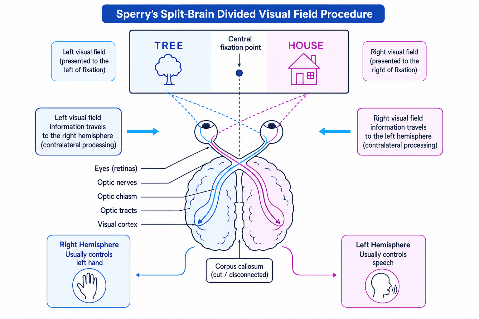 Schematic of Sperry’s split-brain divided visual field procedure showing contralateral processing and disconnected hemispheres