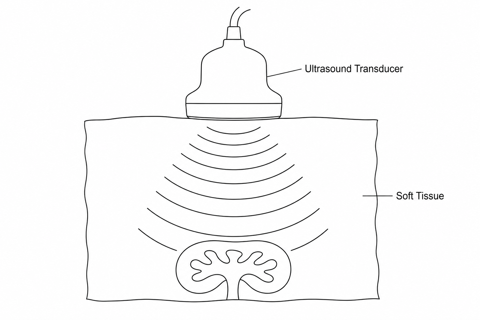 Ultrasound scan diagram