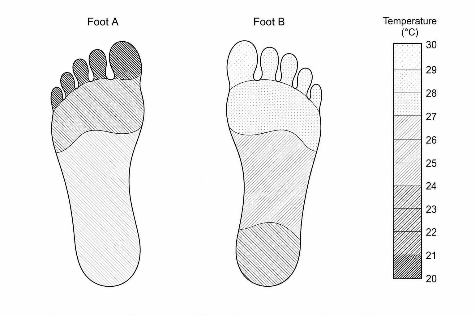 Thermogram of two feet, labeled Foot A and Foot B. Foot A shows toes with very dark shading, corresponding to a temperature scale of 22 to 24 ^\circ\text{C}. Foot B shows toes with light grey shading, corresponding to a temperature scale of 27 to 29 ^\circ\text{C}. A vertical temperature scale bar on the right side goes from 20 ^\circ\text{C} (darkest/black) at the bottom to 30 ^\circ\text{C} (lightest/white) at the top.