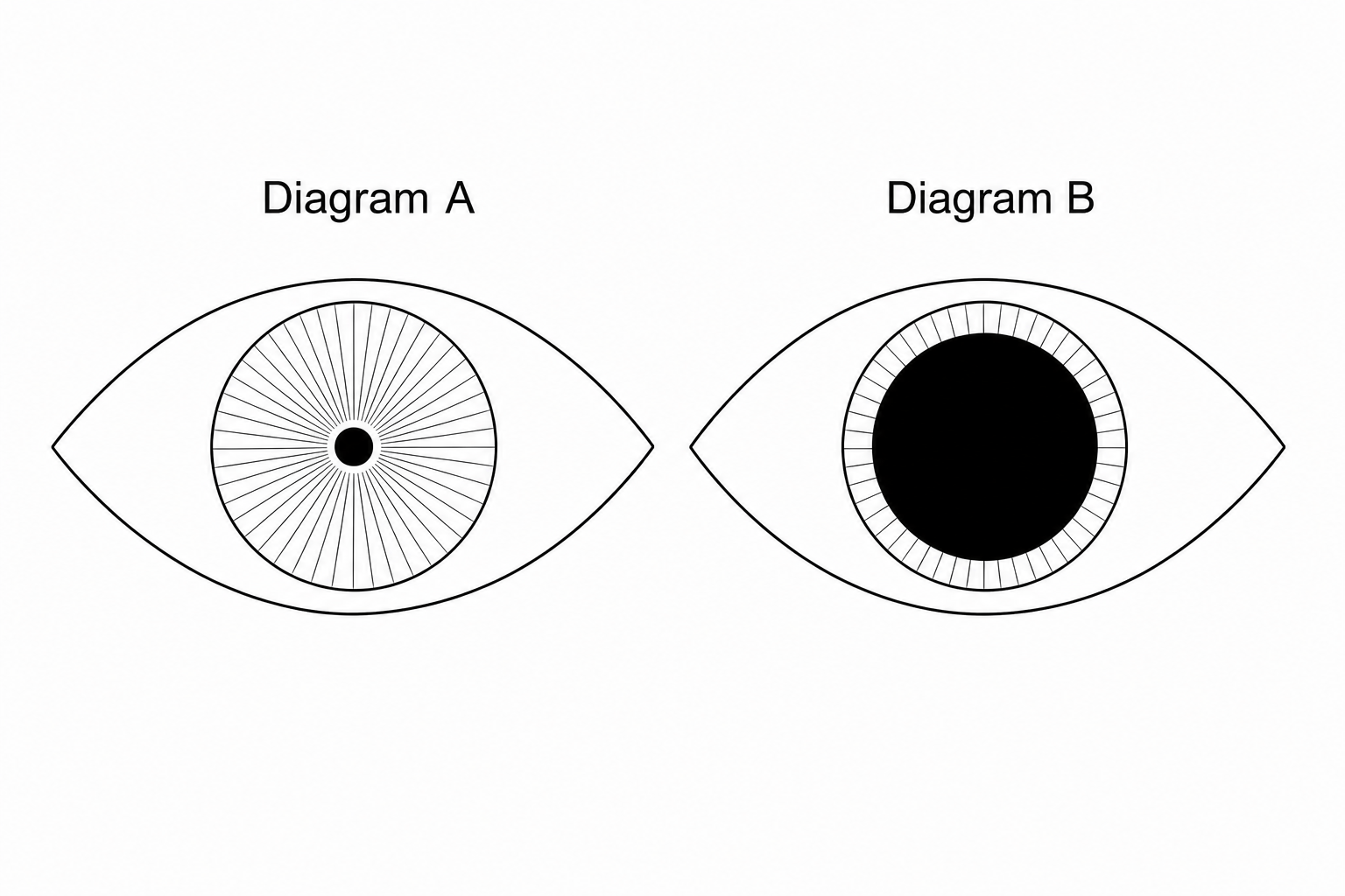 Two diagrams of an eye. Diagram A shows an eye with a very small, constricted pupil at the center of the iris. Diagram B shows the same eye but with a very large, dilated pupil occupying most of the iris.