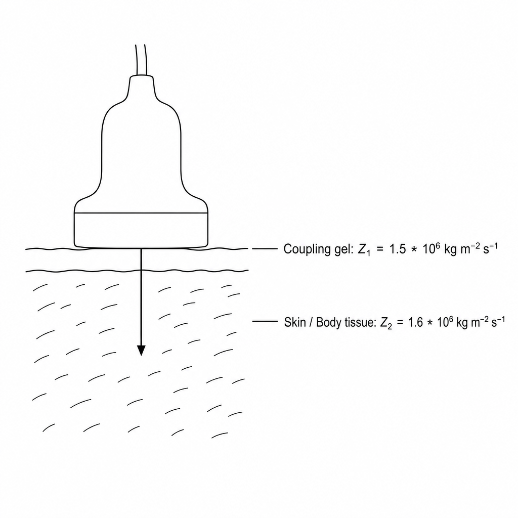 Ultrasound coupling gel boundary