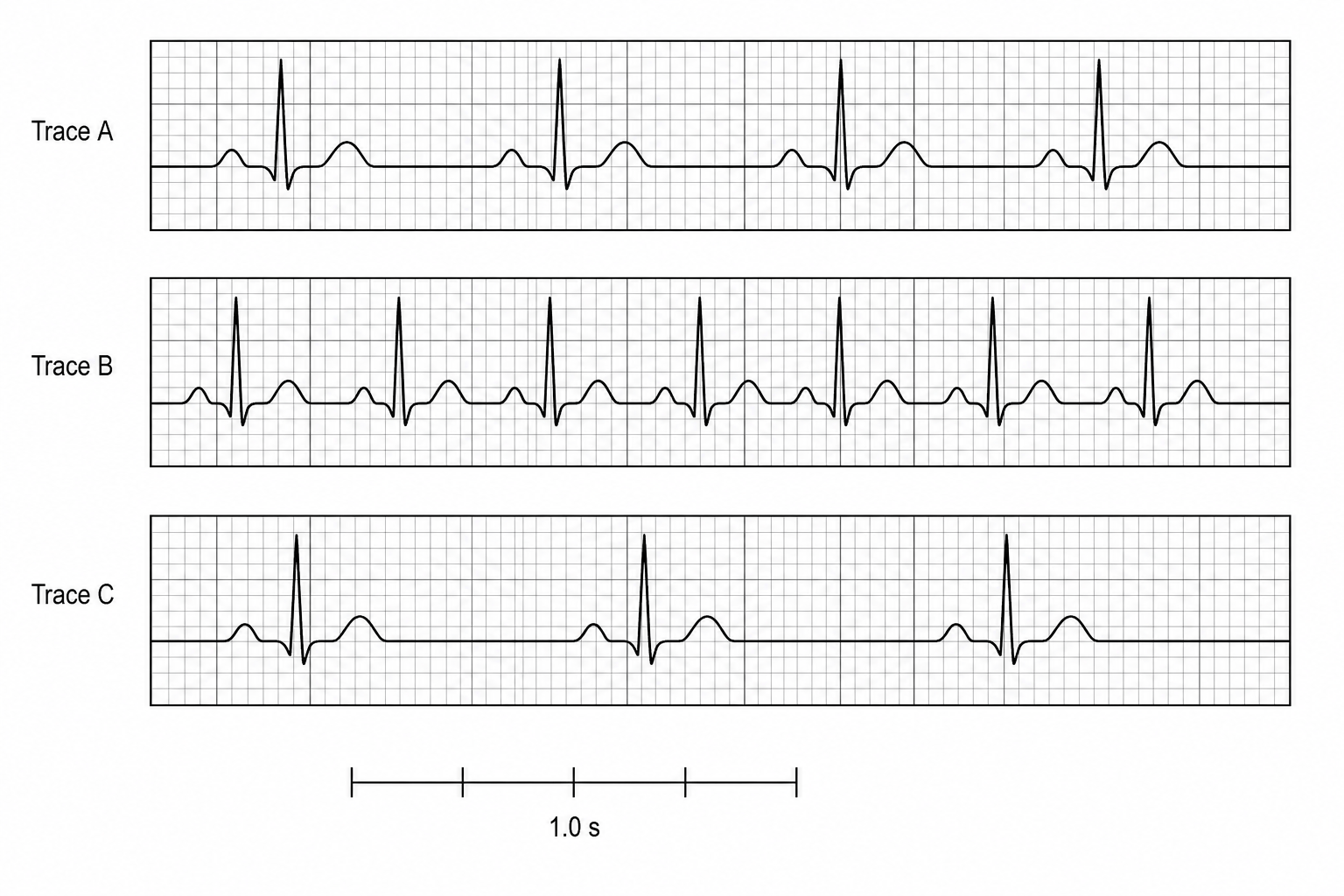 Three resting ECG traces drawn on a grid where 5 horizontal large squares represent 1.0 s. Trace A shows R-waves (the sharp vertical peaks) spaced exactly 5 large squares apart. Trace B shows R-waves spaced exactly 3 large squares apart. Trace C shows R-waves spaced exactly 7.5 large squares apart. At the bottom, a time scale bar of 5 large squares is labeled 1.0 s.