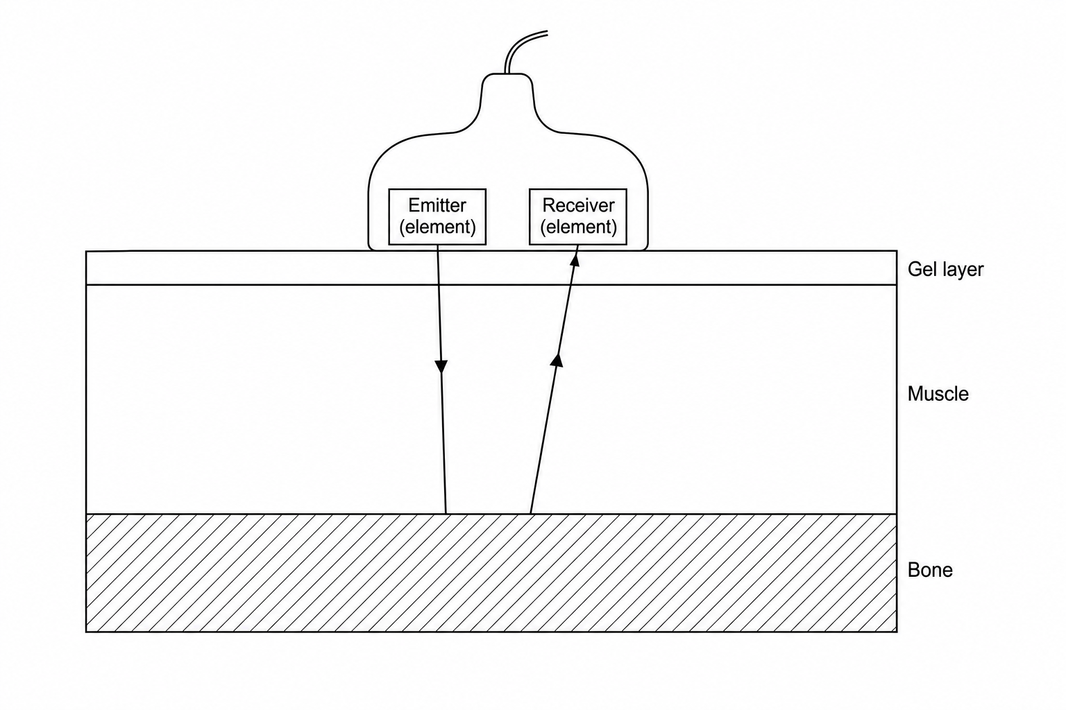 Ultrasound scan diagram