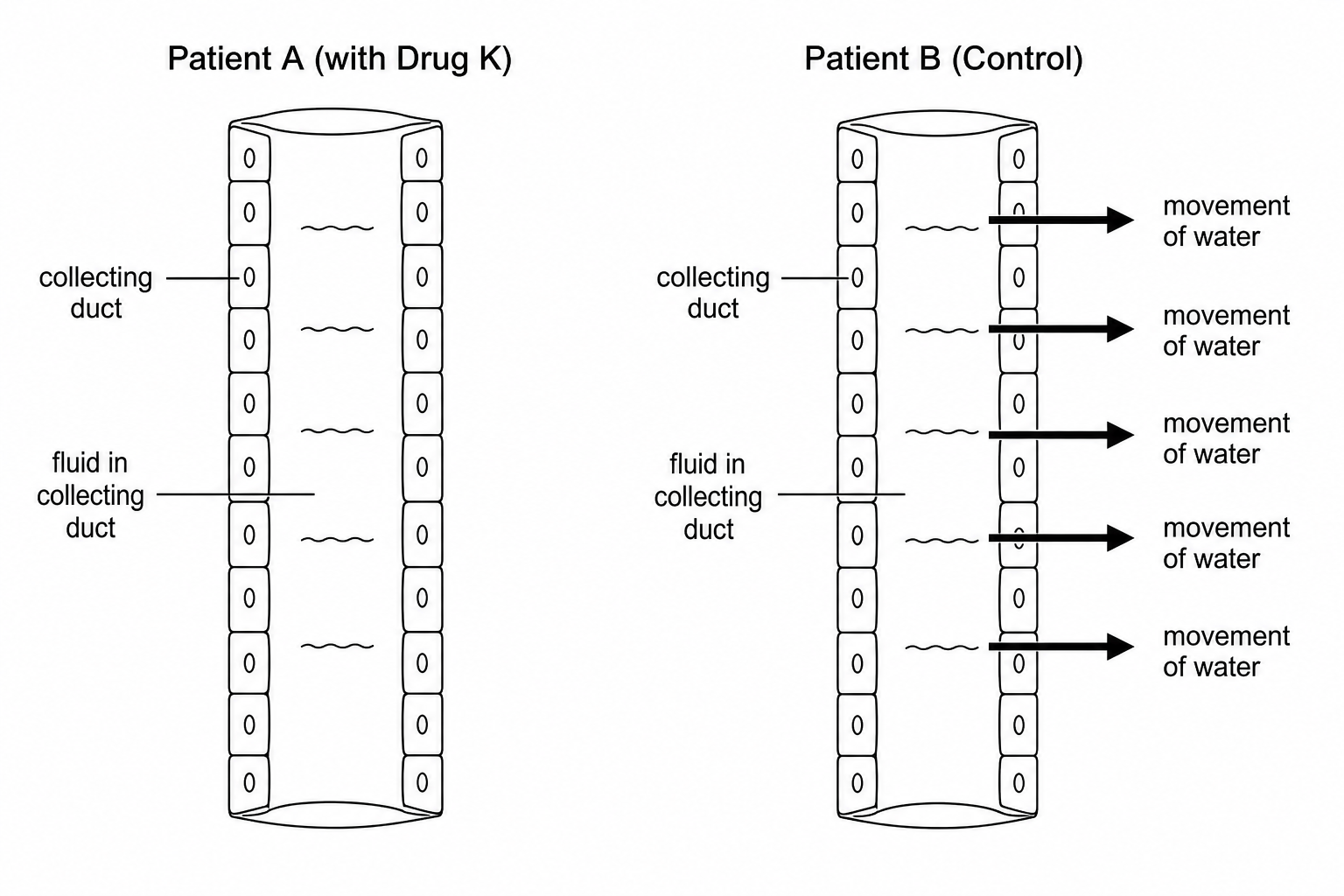 Diagram showing collecting ducts of Patient A and Patient B