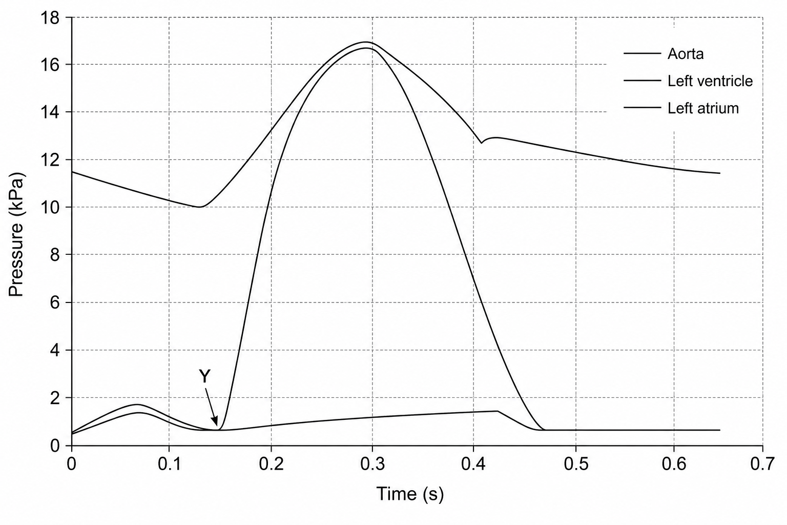 Cardiac pressure graph