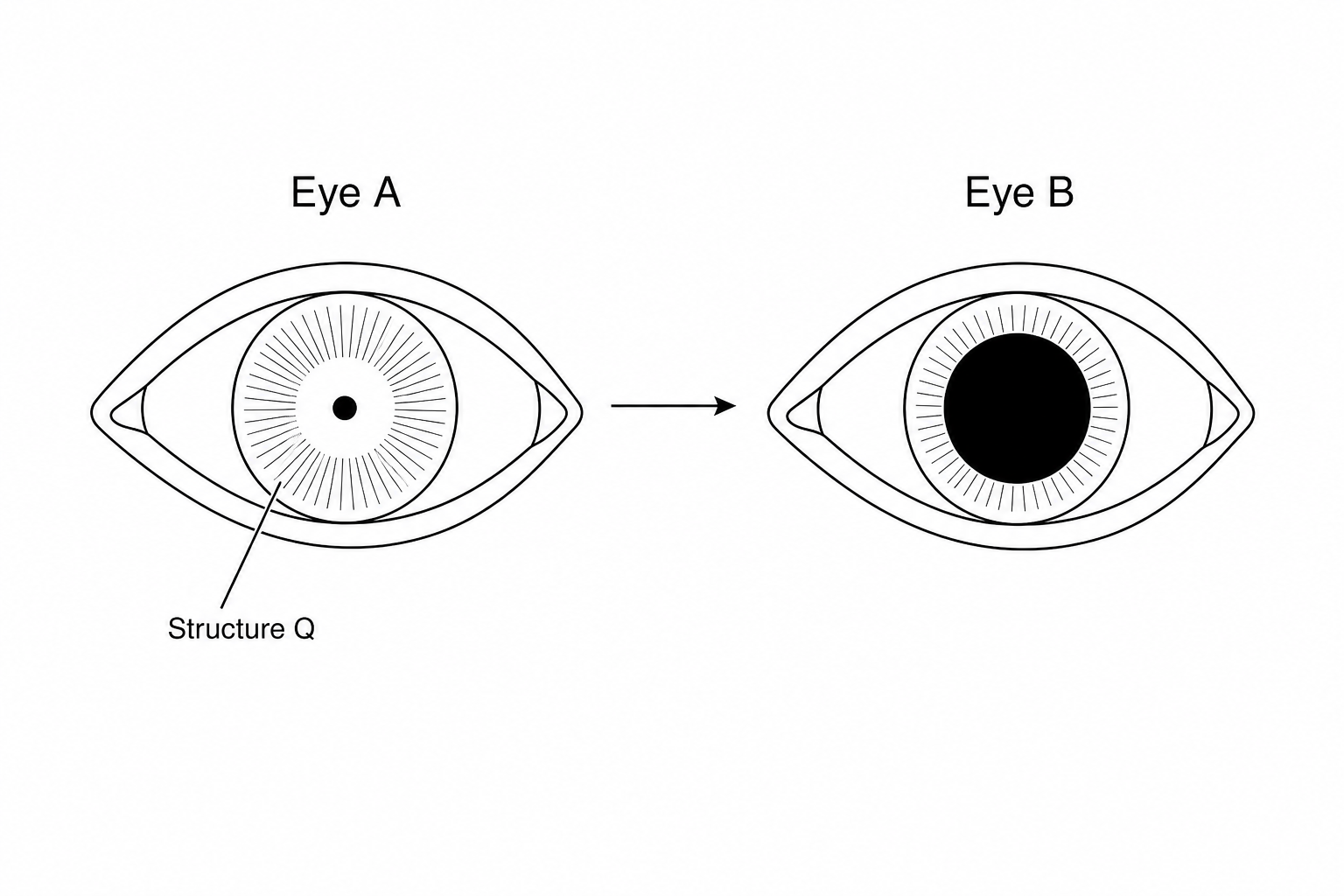 Figure 1: Two simplified diagrams of a human eye. Eye A shows a very small, constricted pupil at the center of the iris (labeled as Structure Q). Eye B shows a very large, dilated pupil at the center of the iris. An arrow points from Eye A to Eye B, indicating the transition from constricted to dilated.