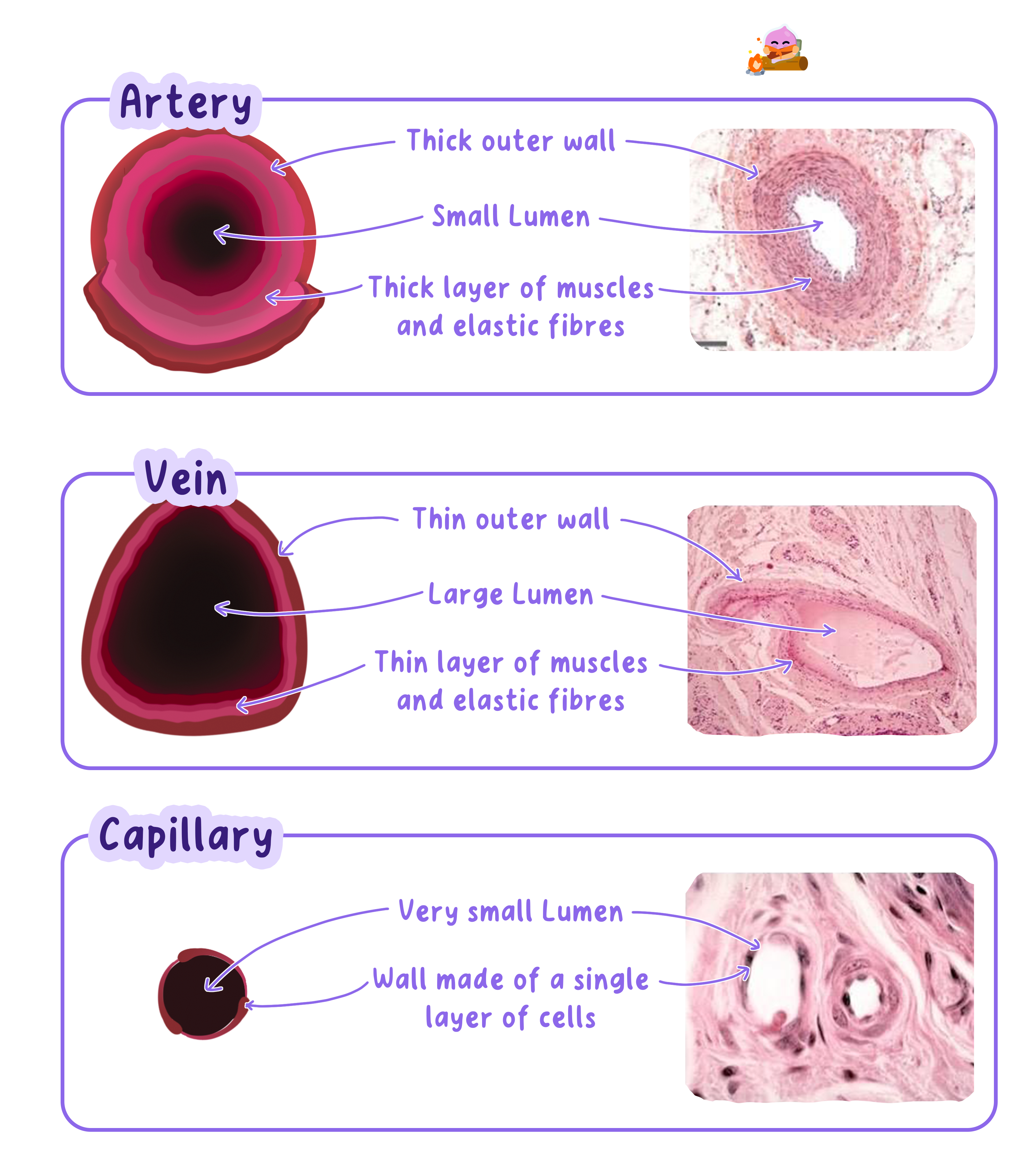 A comparison of the structure of an artery, a vein, and a capillary. Diagrams and micrographs show the thick muscular and elastic walls and small lumen of an artery, the thinner walls and large lumen of a vein, and the single-cell thick wall and very small lumen of a capillary.