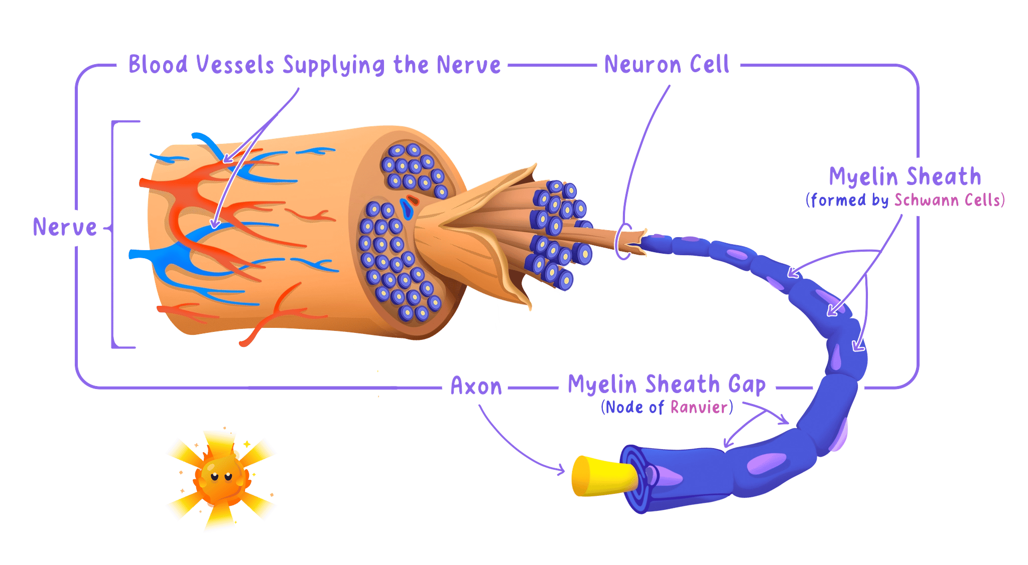 A cross-section through a nerve showing that it is a bundle of many neurones, with one neurone enlarged to show the axon surrounded by a fatty myelin sheath broken by gaps, and the blood vessels supplying the nerve.