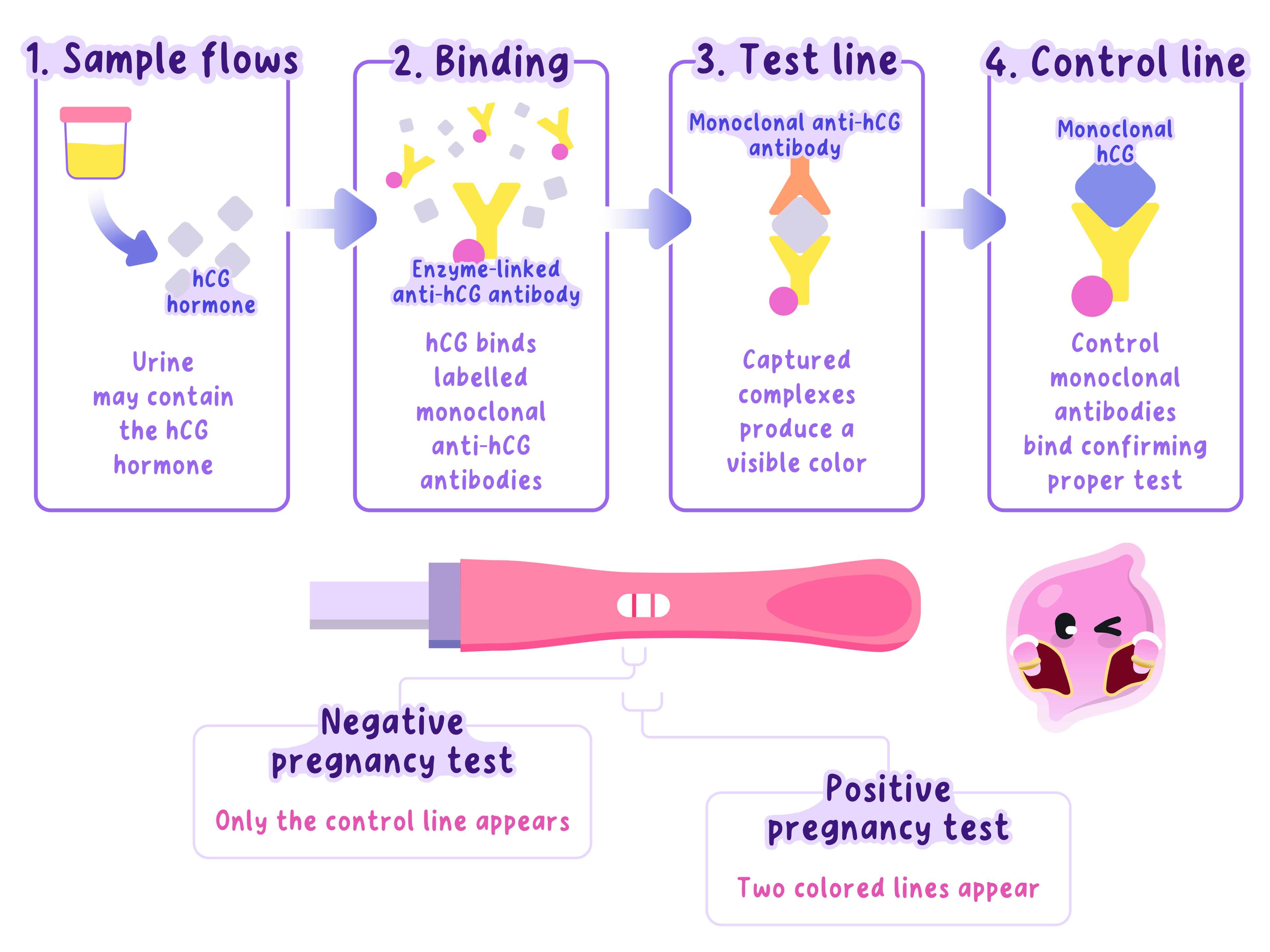 Diagram showing how a pregnancy test uses monoclonal antibodies to detect hCG in urine. It illustrates the binding of hCG to labelled antibodies, the formation of a colored test line, and the control line. Includes positive and negative result examples.
