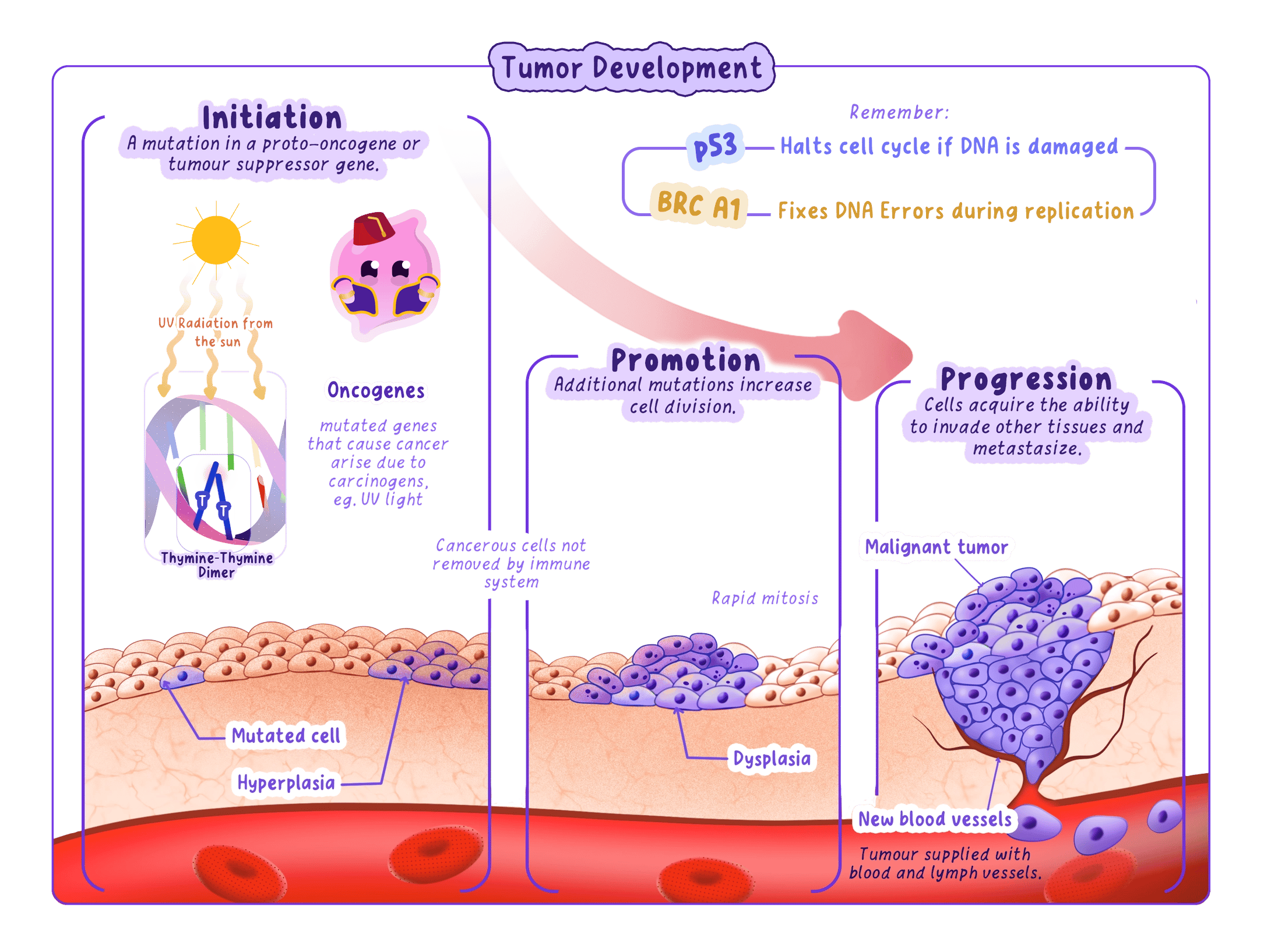 The stages of tumour development: ultraviolet radiation causes a mutation in a skin cell, repeated uncontrolled division then builds up a mass of abnormal cells, and finally the tumour becomes malignant as its cells invade a blood vessel and spread.