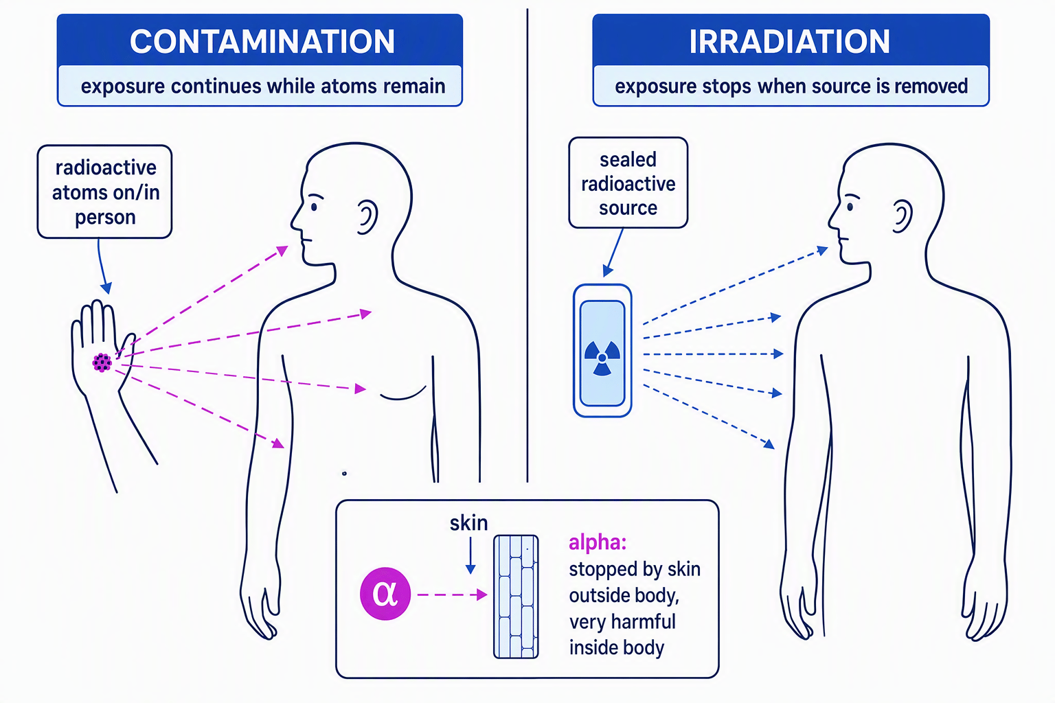 Comparison of radioactive contamination and irradiation, including alpha radiation outside and inside the body