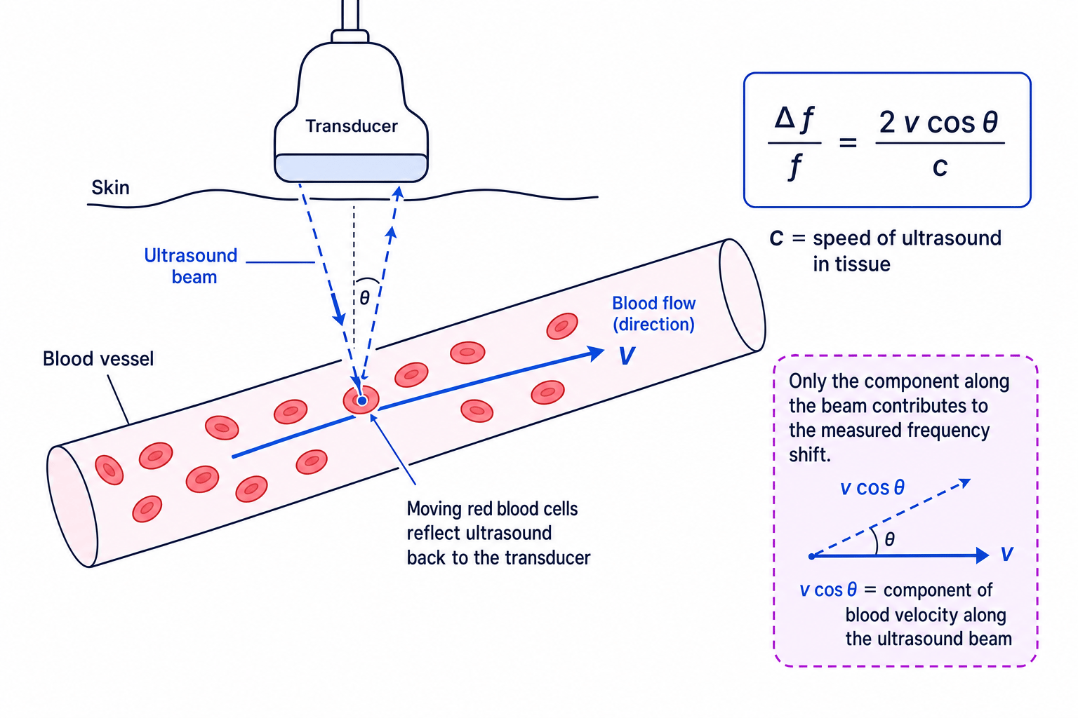 Doppler ultrasound measurement geometry for blood flow