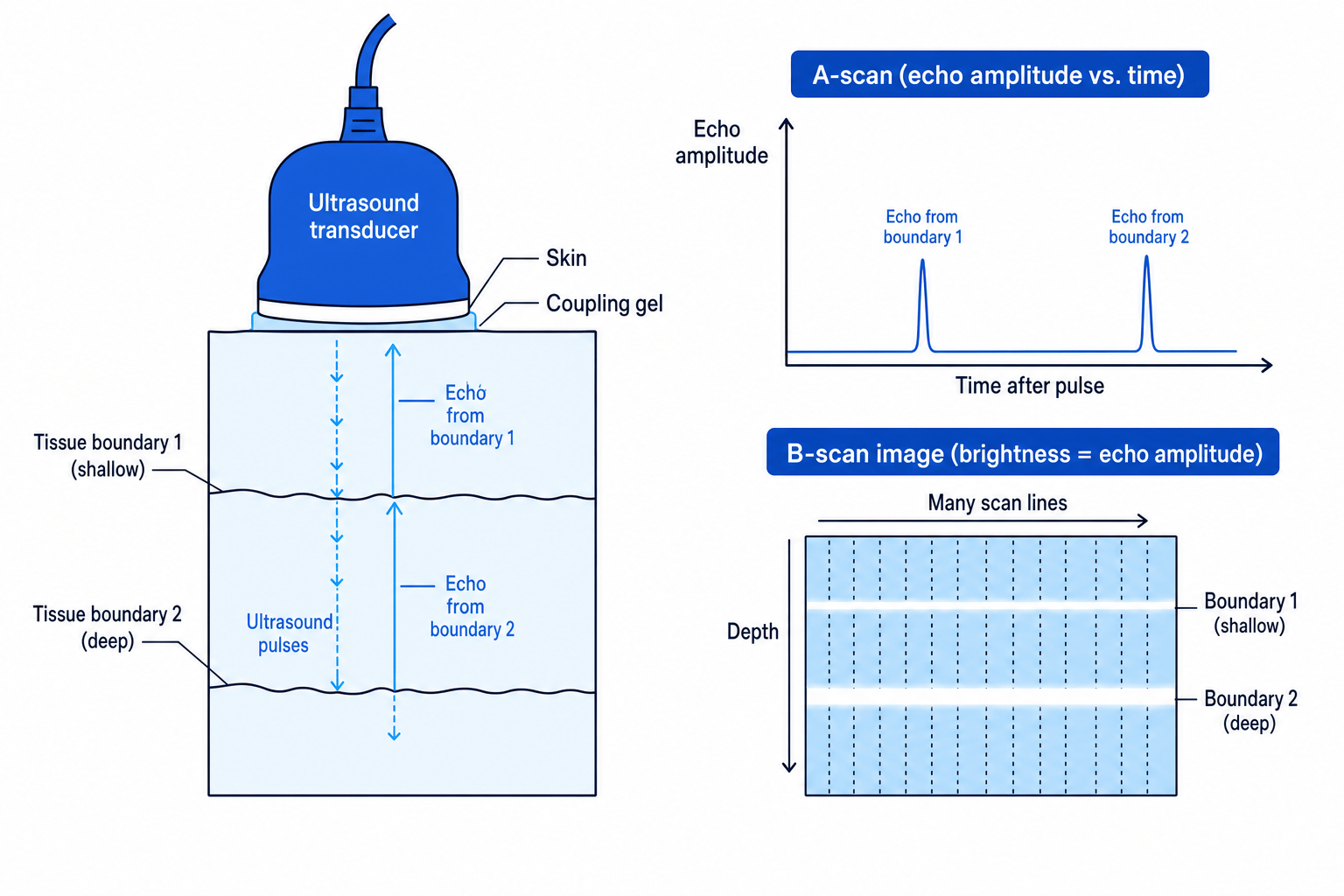 Ultrasound pulse-echo scanning with A-scan and B-scan displays