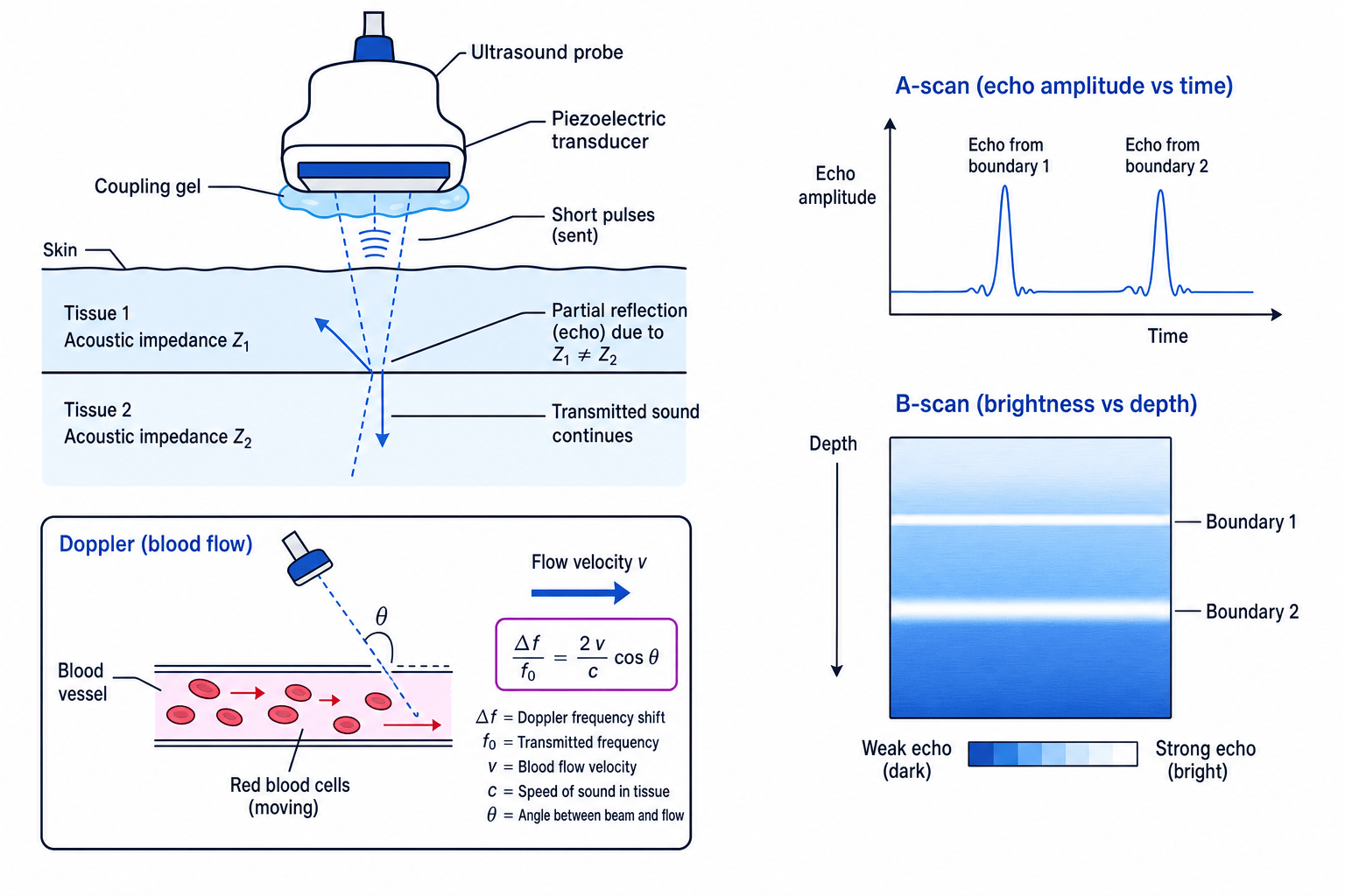 Ultrasound pulse echo, acoustic impedance, A-scan, B-scan and Doppler schematic